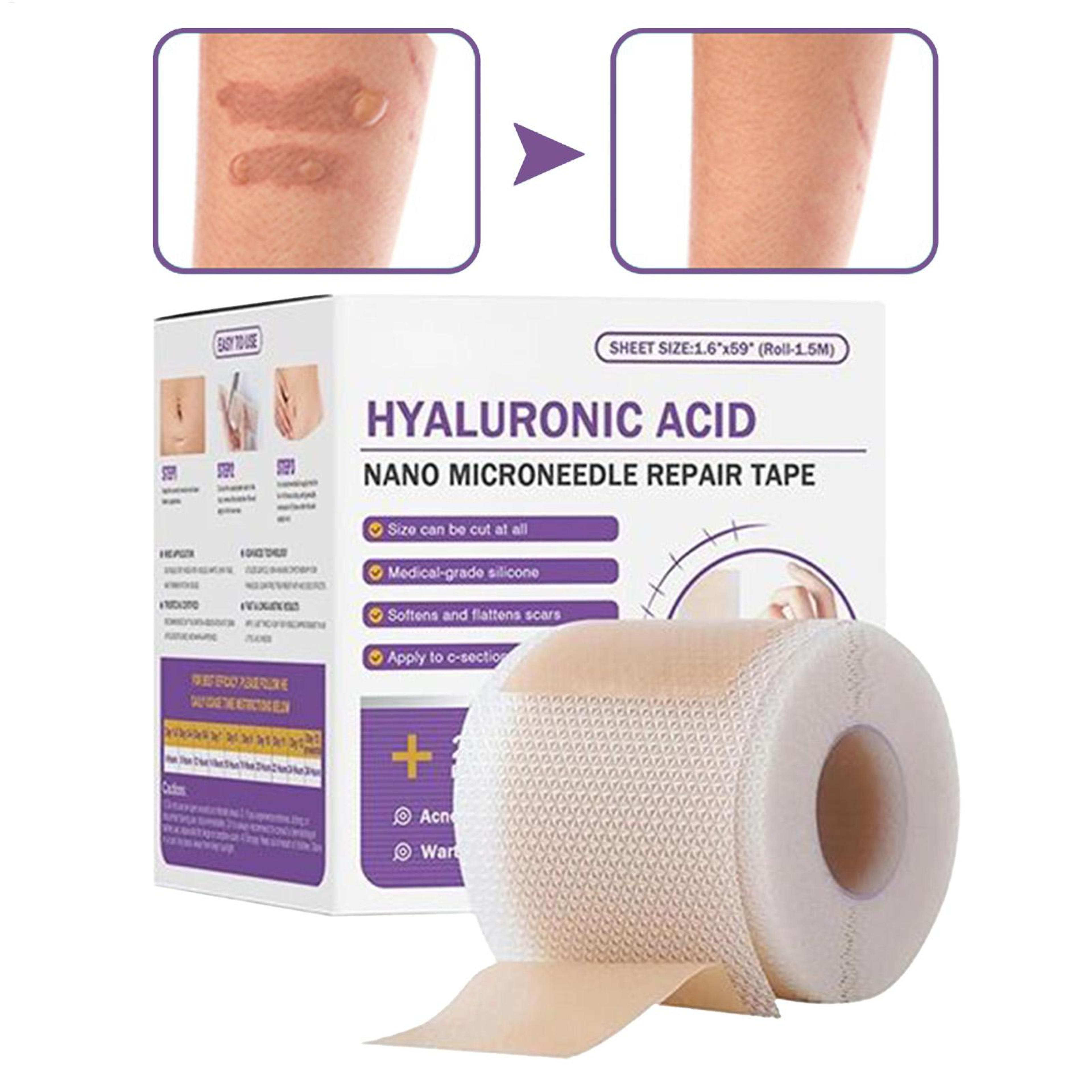 advanced surgical soft silicone scar patch for acne, burn & trauma skin repair