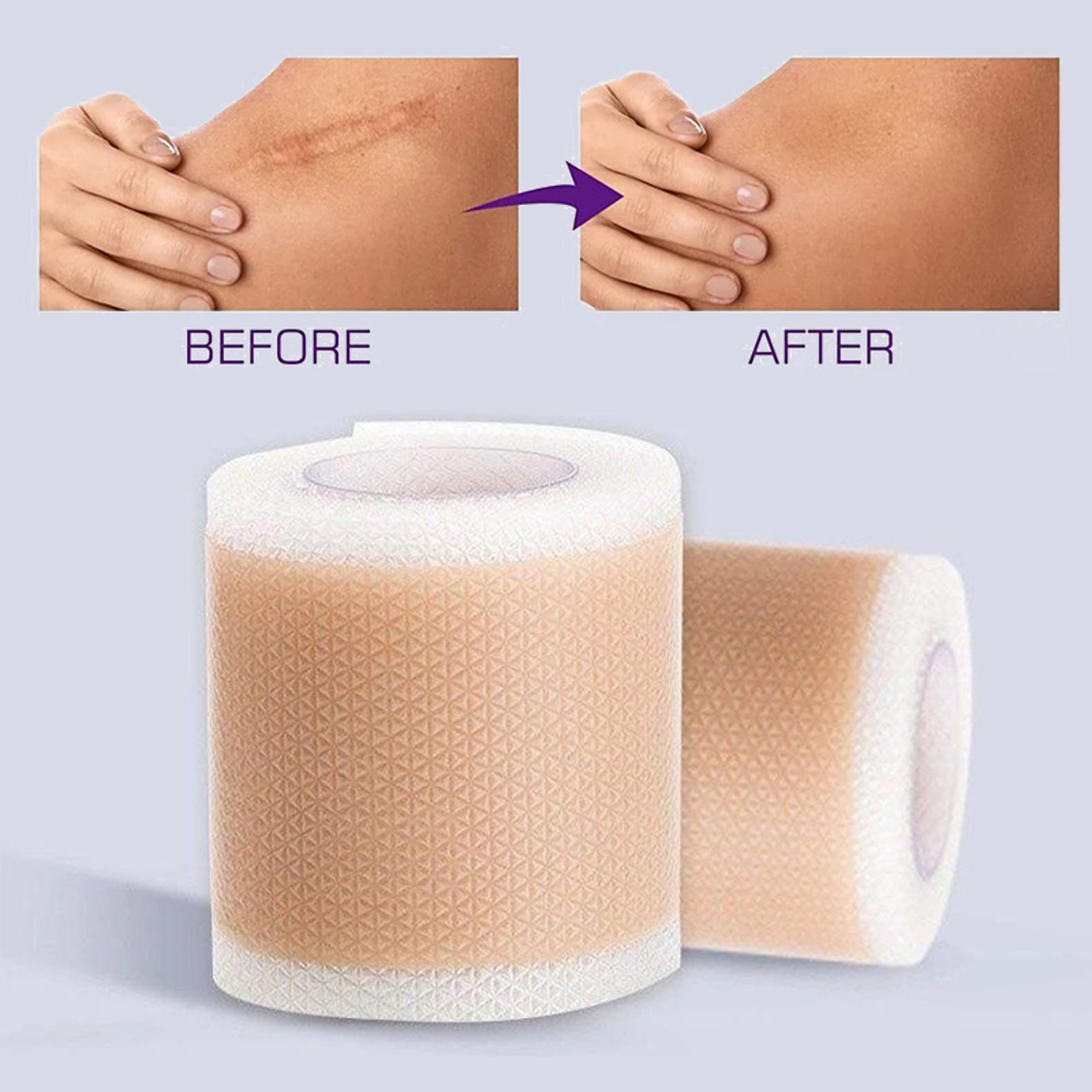 advanced silicone scar tape waterproof, breathable & reusable scar patch for skin protection and comfort