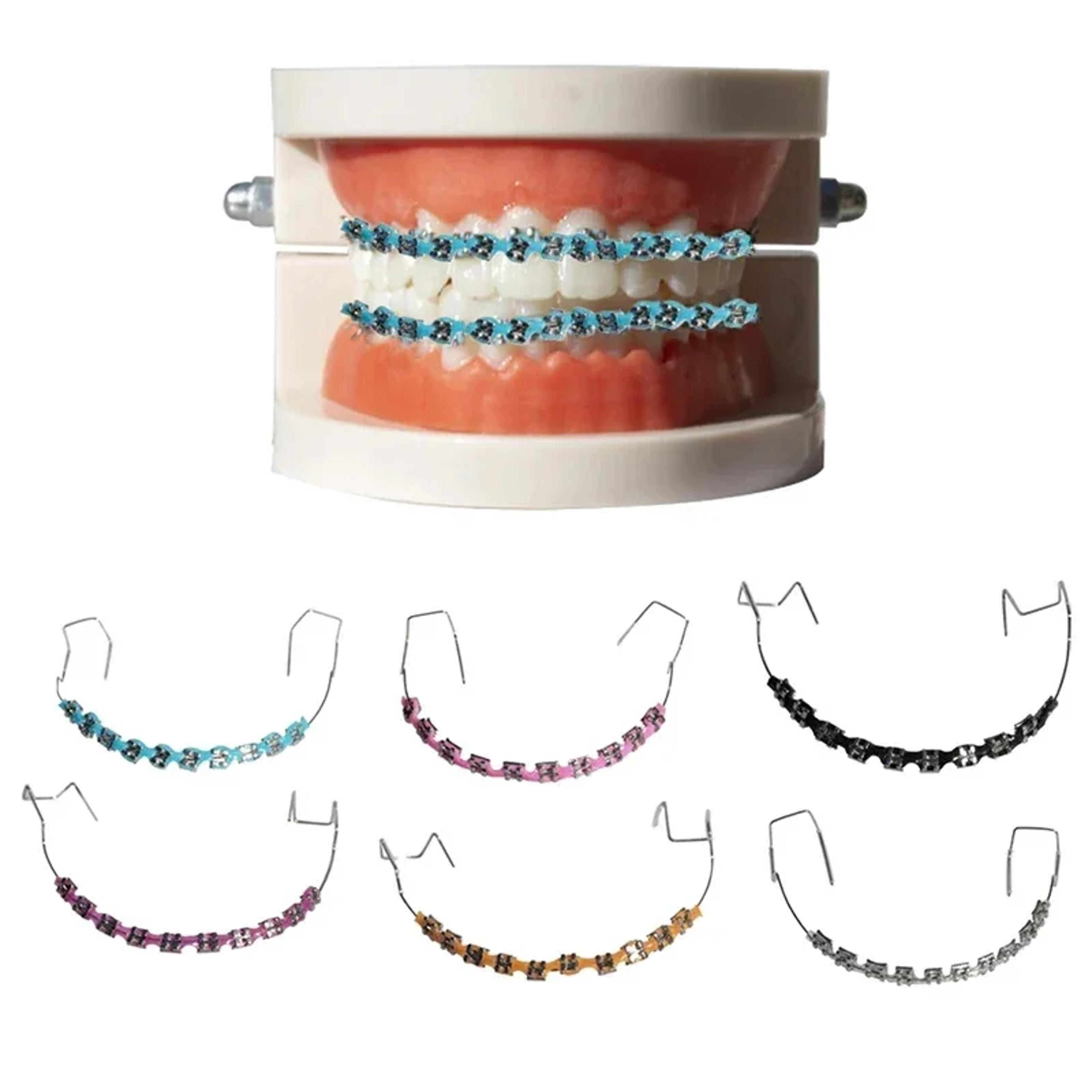 metal bracket fashion braces, colorful temporary tooth decoration, high-quality orthodontic ligature ties