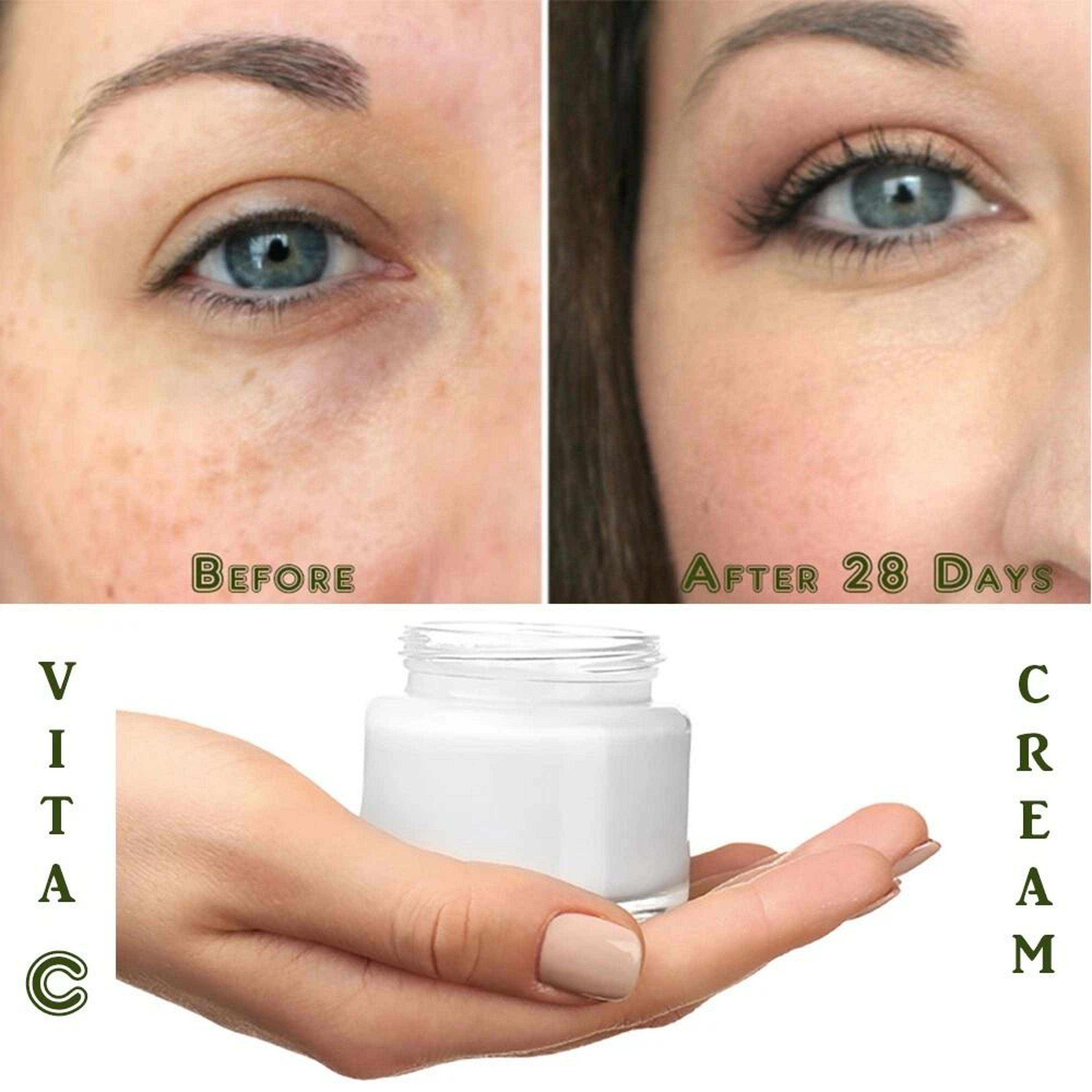matrixyl anti-aging vitamin c cream with hyaluronic acid and retinol
