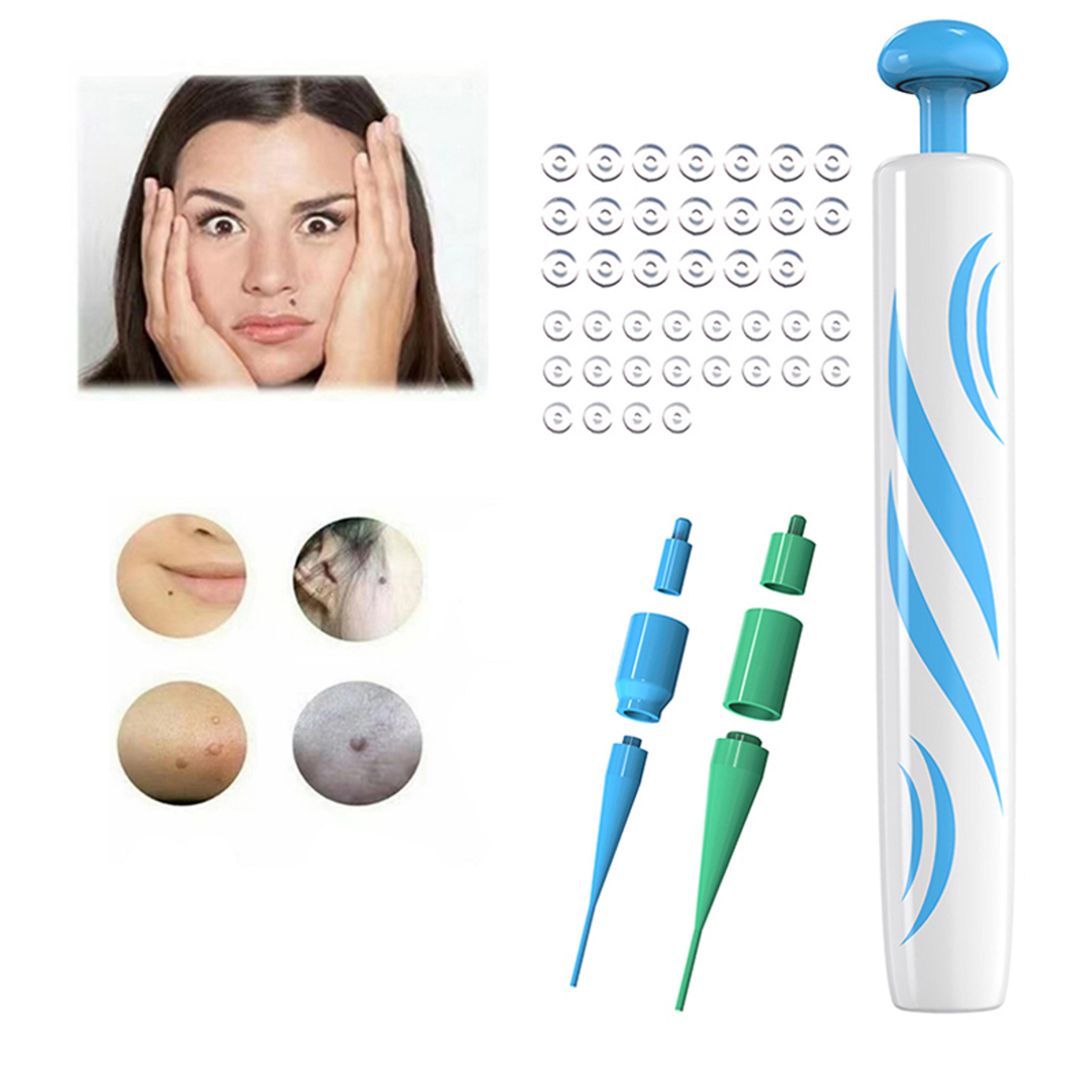 2 in 1 auto micro skin tag remover device kit, standard face cleaner for adult mole, wart, black dots remover, painless