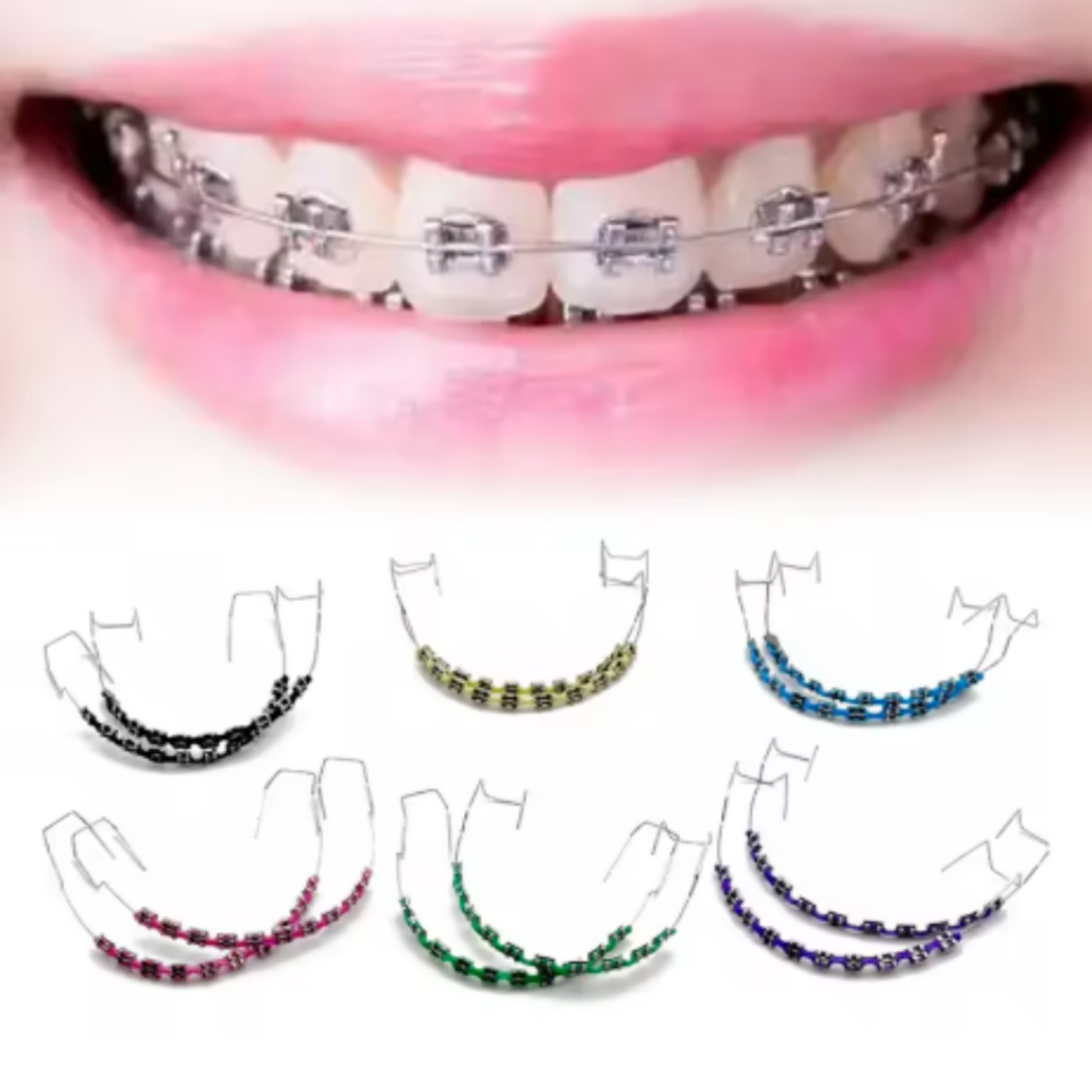 colorful fake braces for teeth with metal wires and orthodontic ligature ties