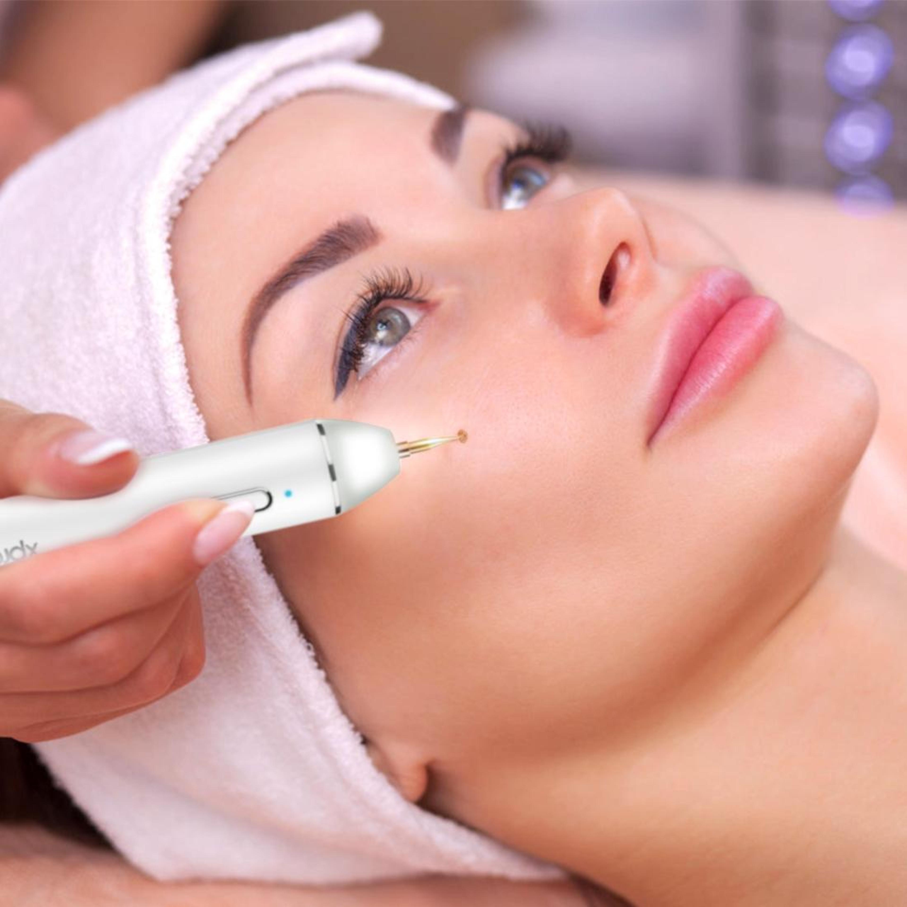precision skin tag & spot removal pen home wart, mole & blemish remover with led display