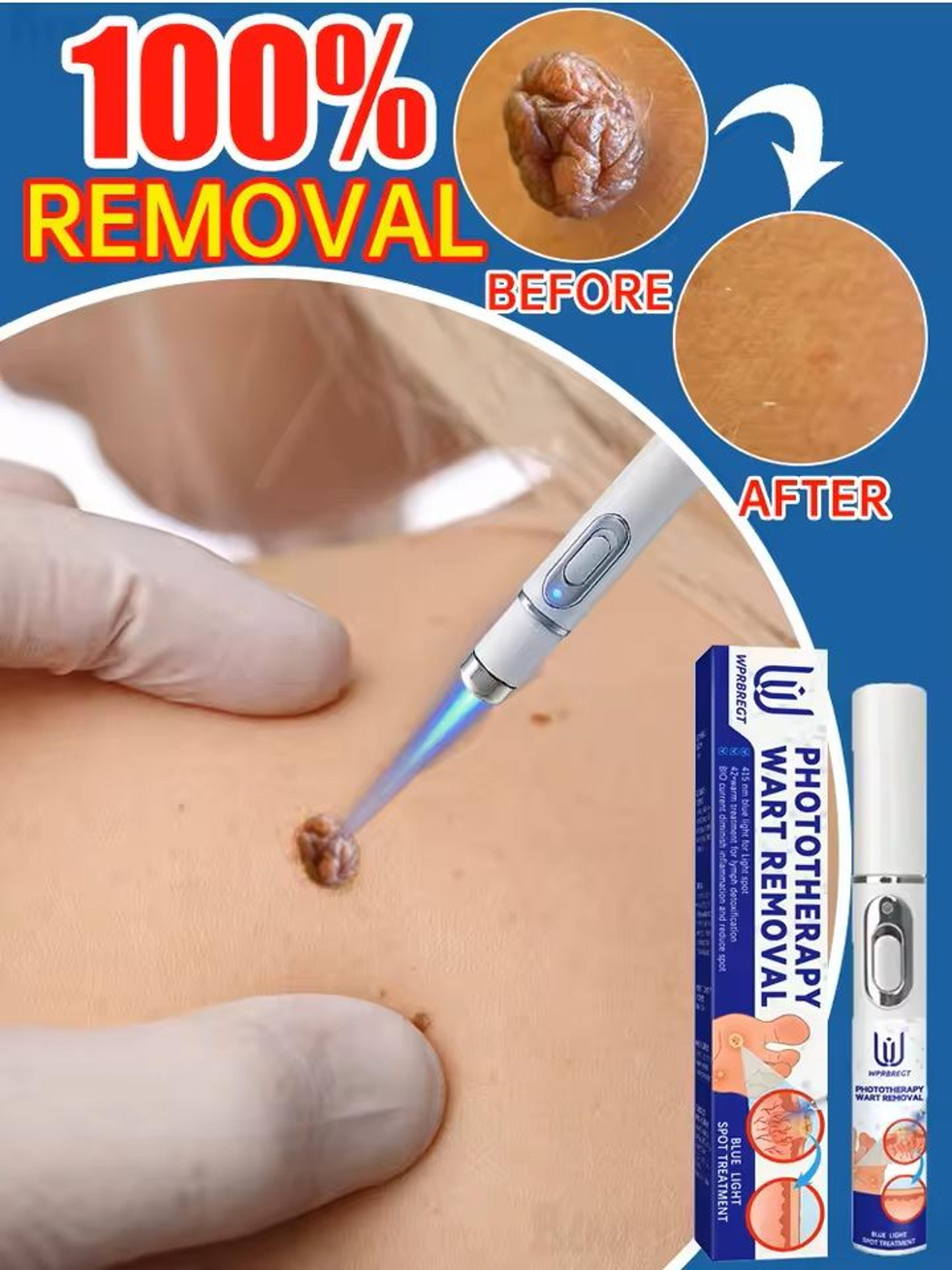 professional skin treatment device