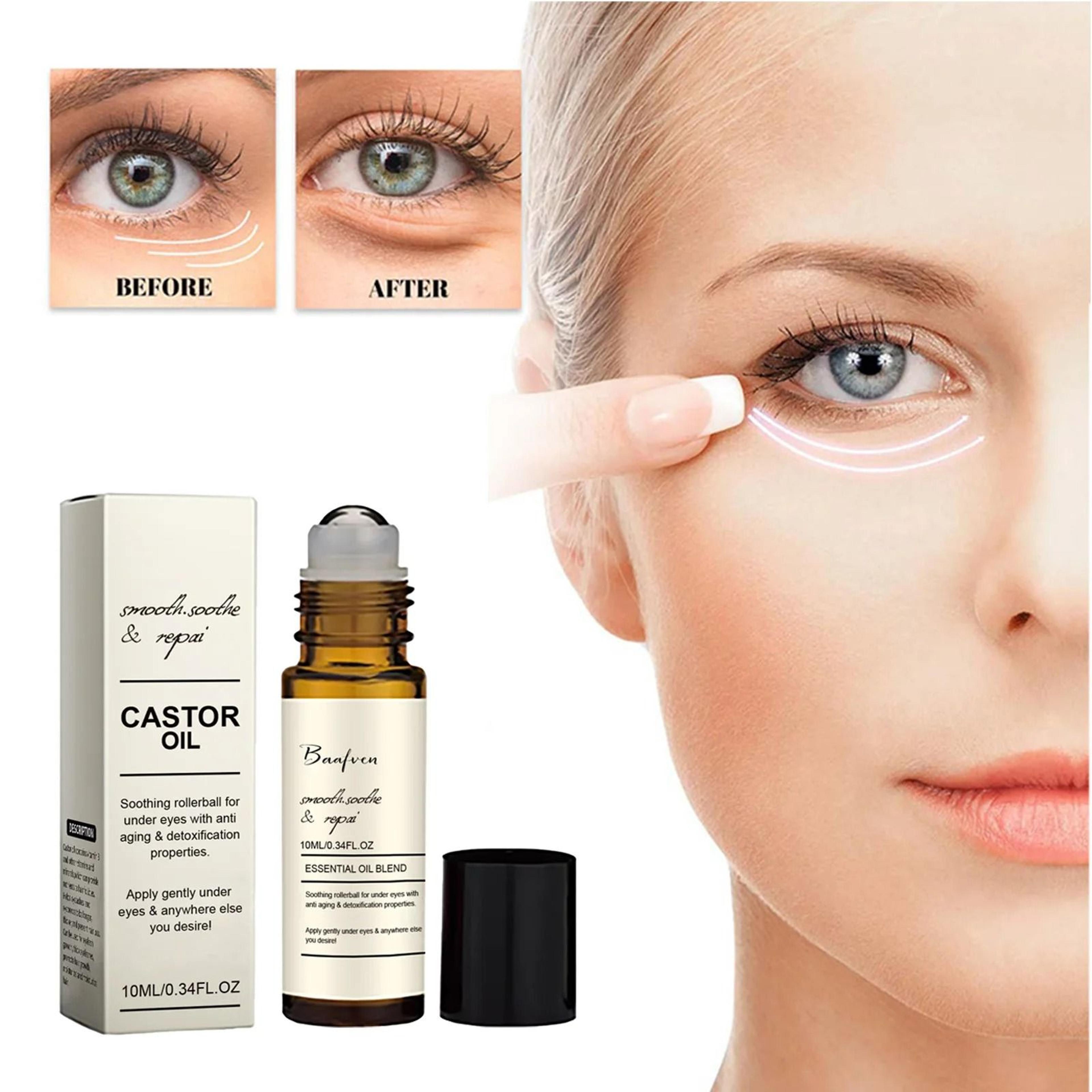 castor oil eye serum anti wrinkle dark circle and puffiness remover