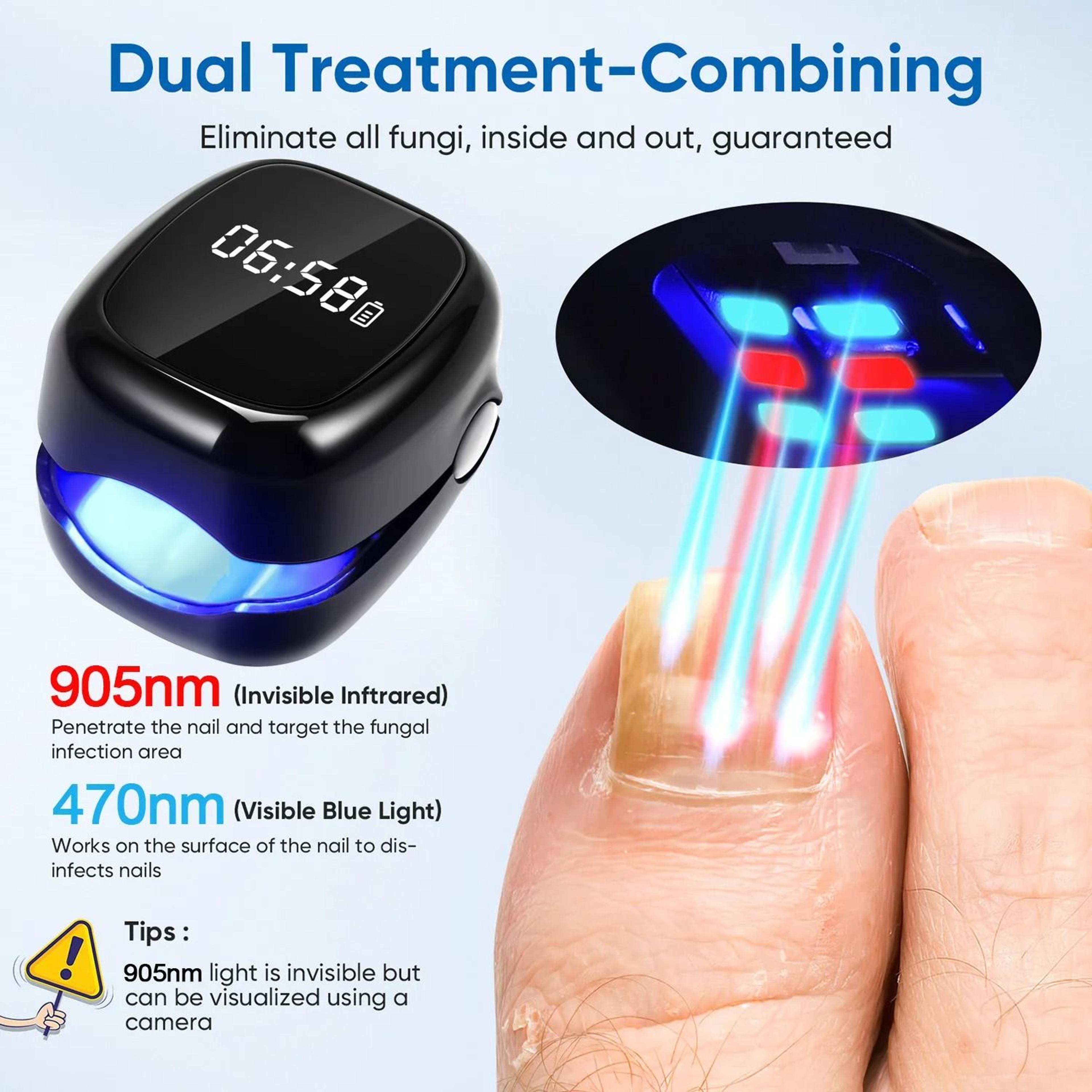 nail care laser device for improving nail appearance and smoothness