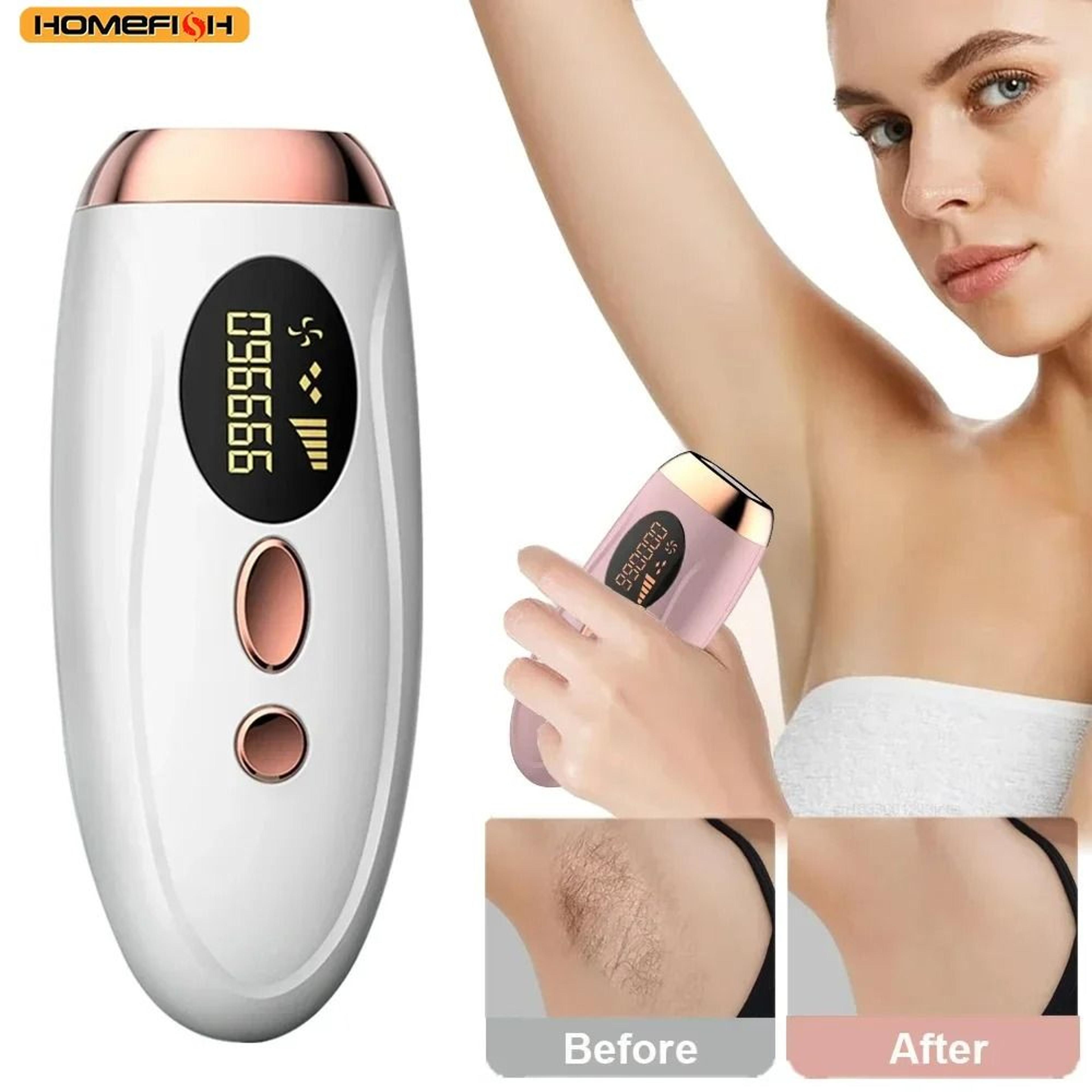 ipl hair removal device for women with 990000 flashes and 5 energy levels