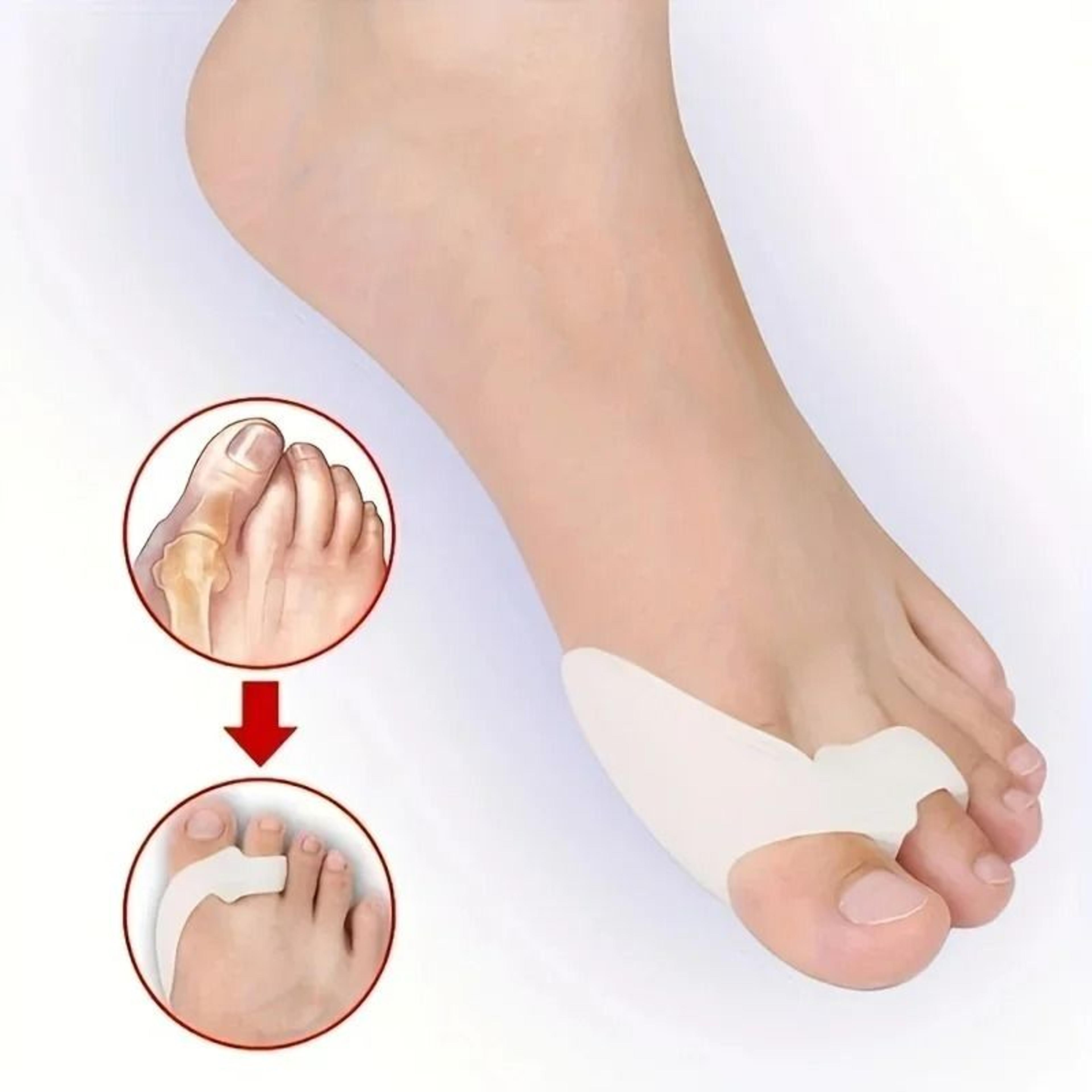 1 pair silicone toe corrector – instant hallux valgus relief & foot comfort