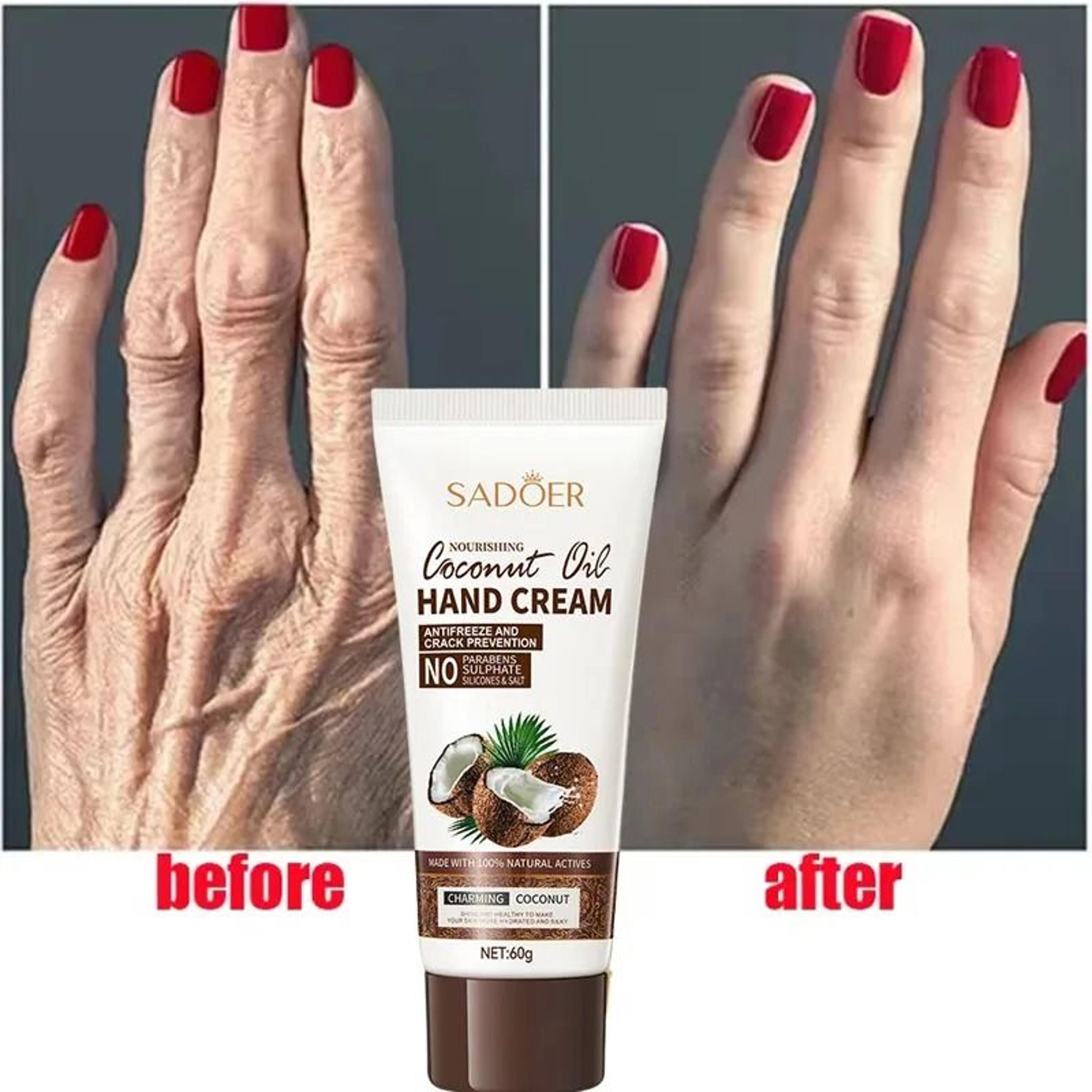 anti-wrinkle coconut oil hand cream – intensive anti-crack & repair serum