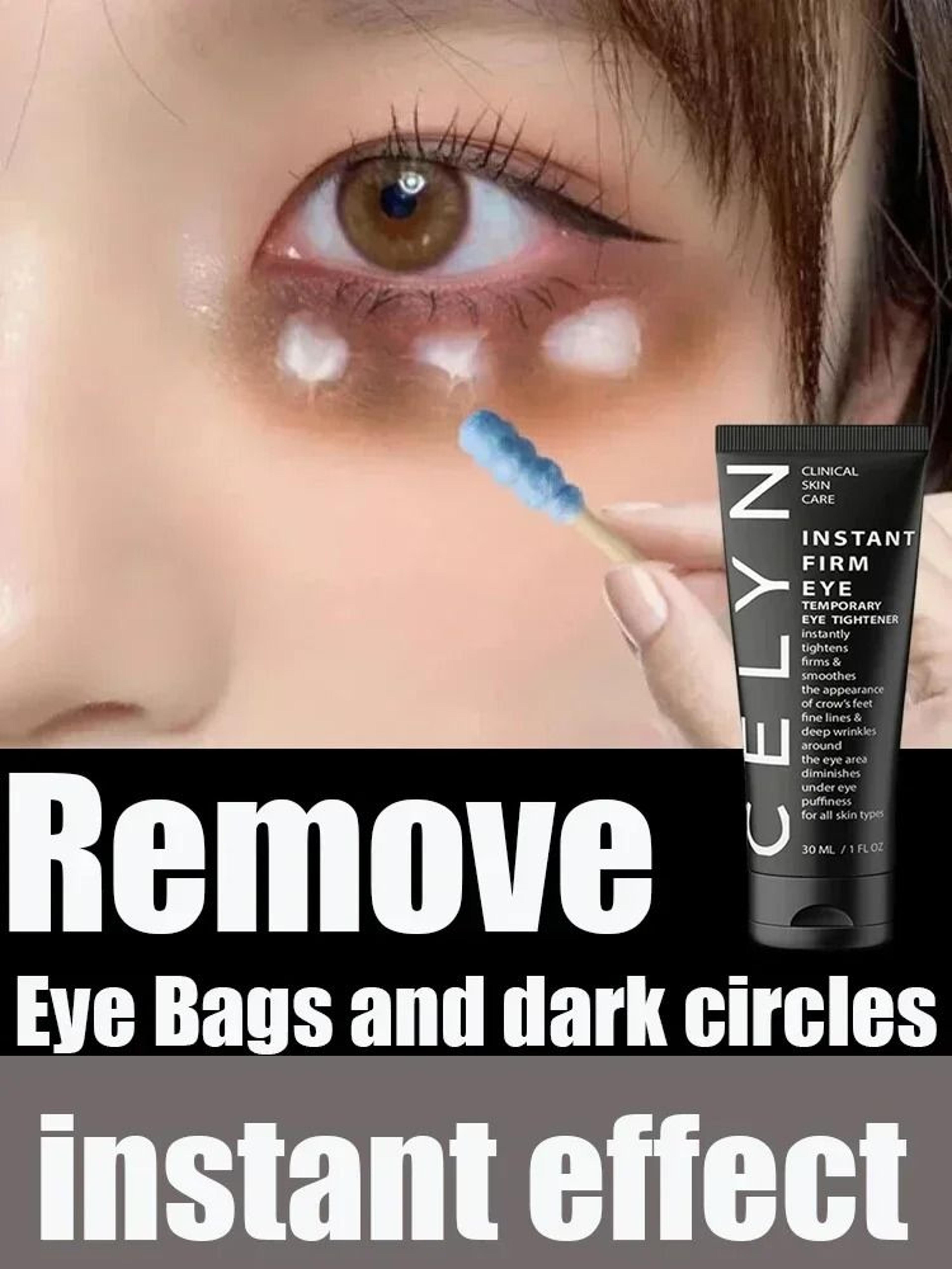 instant eye bag removal cream – collagen infused anti-wrinkle & firming therapy