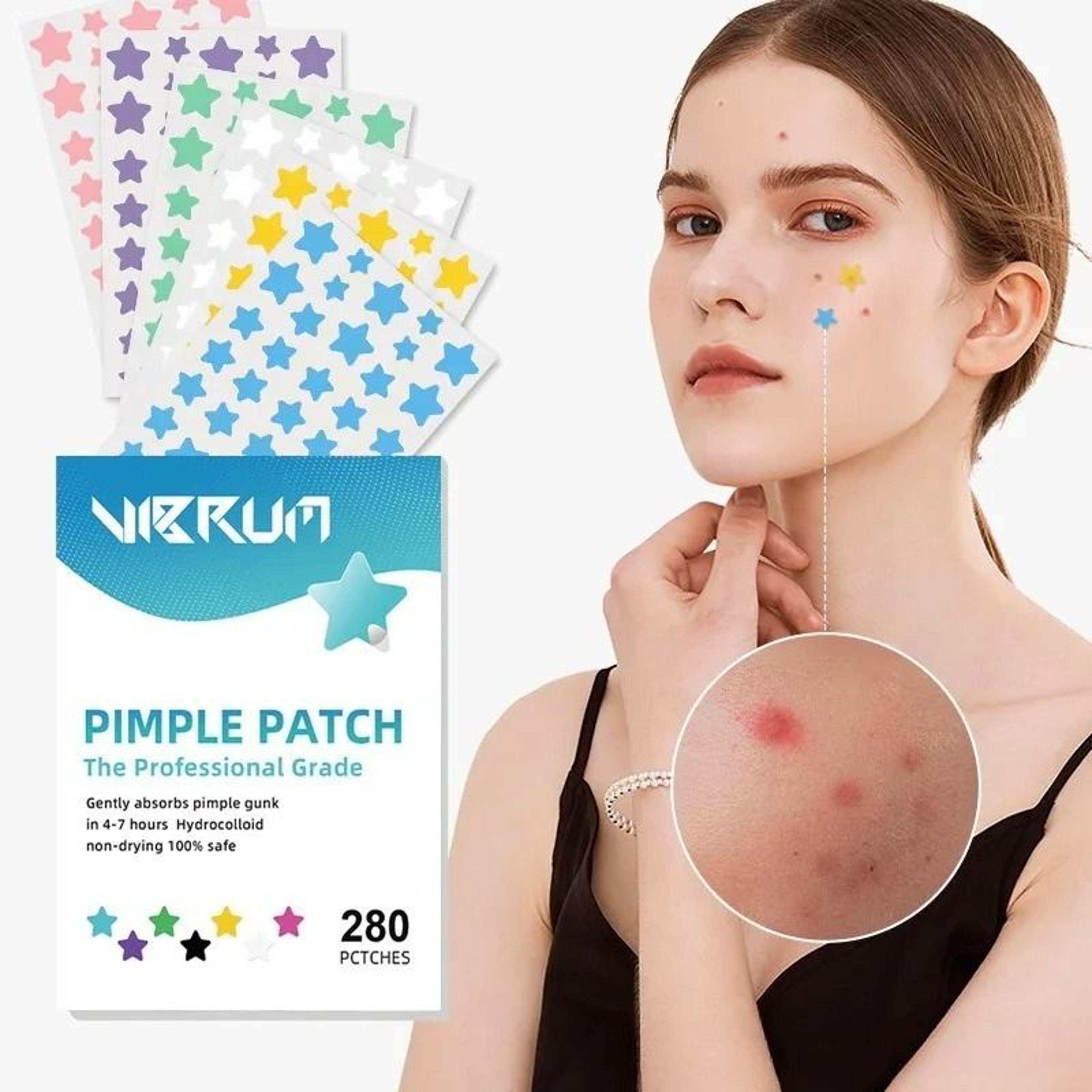 280-piece colorful star-shaped pimple patch set