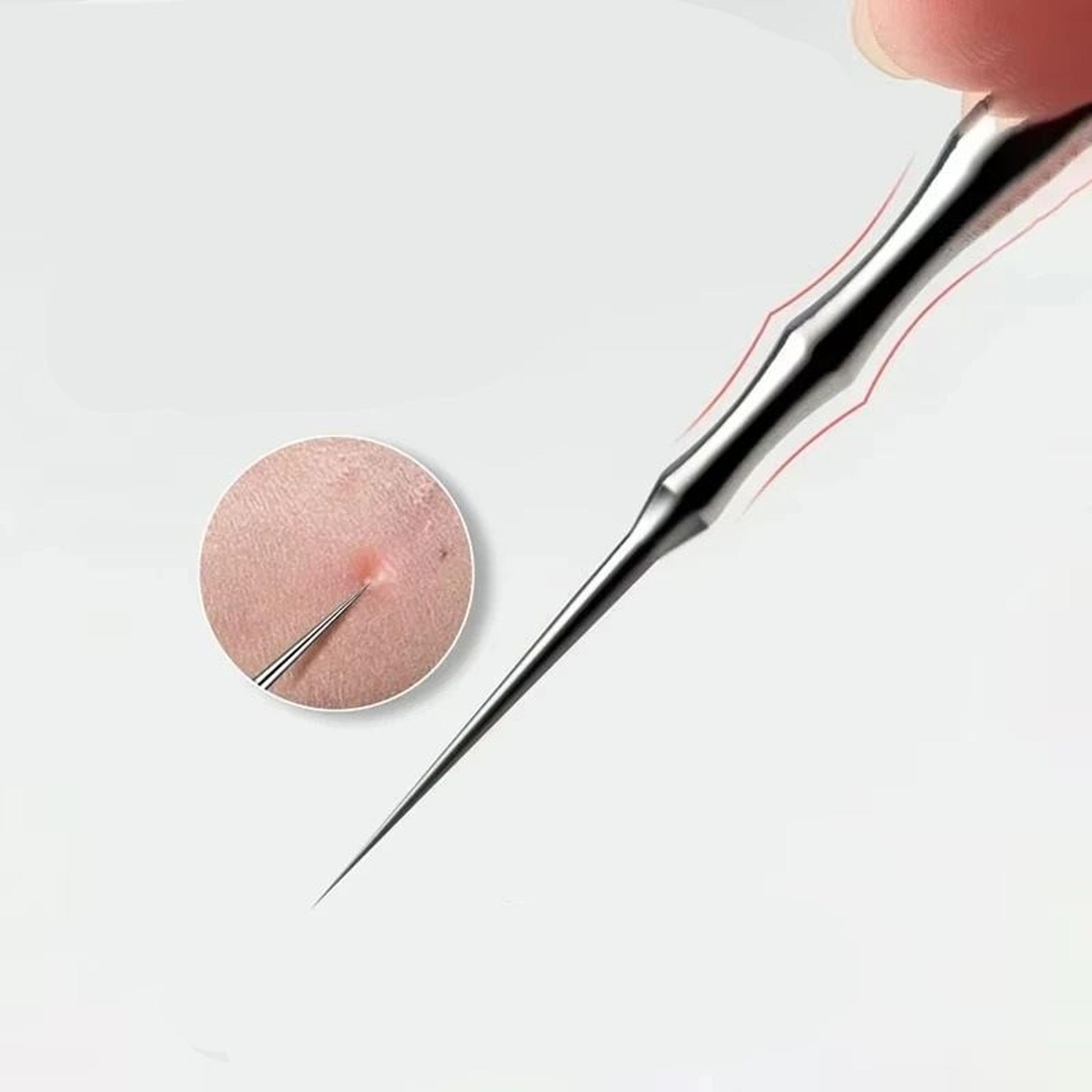 ultra-precision blackhead & pimple extractor