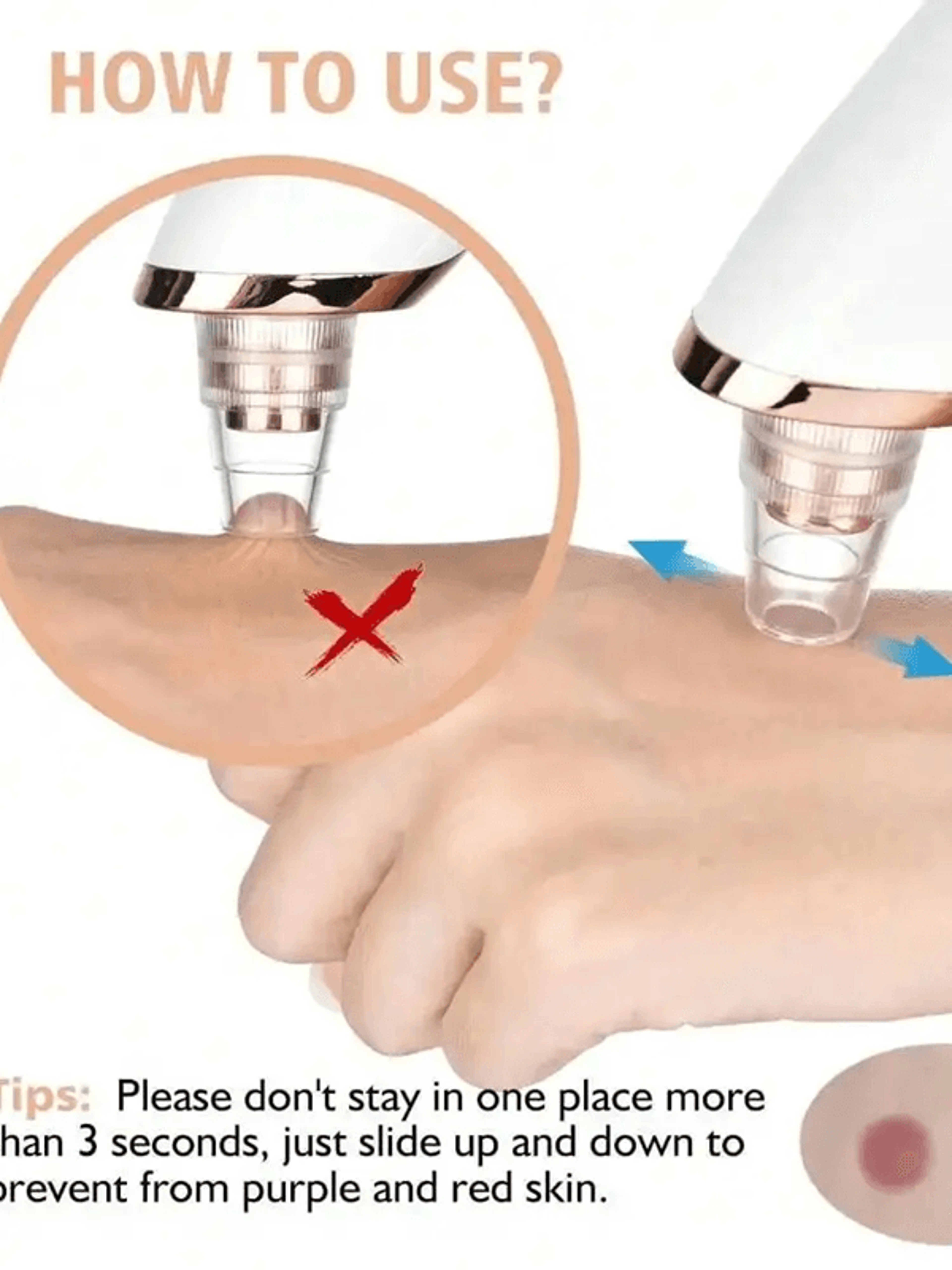 electric blackhead remover pore vacuum facial deep cleansing device