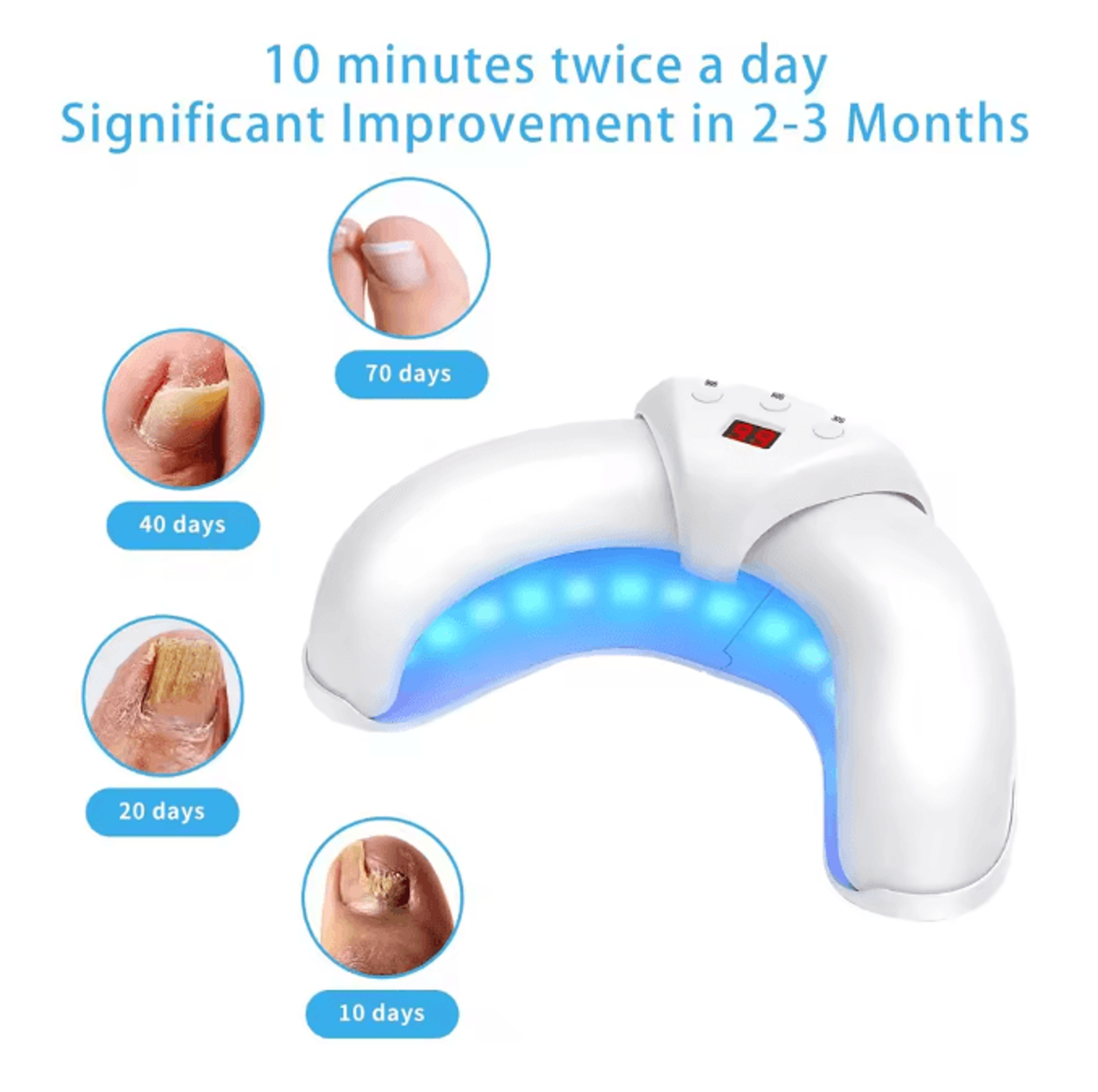 ClearNail Laser Nail Fungus Treatment Device for Toenail Care