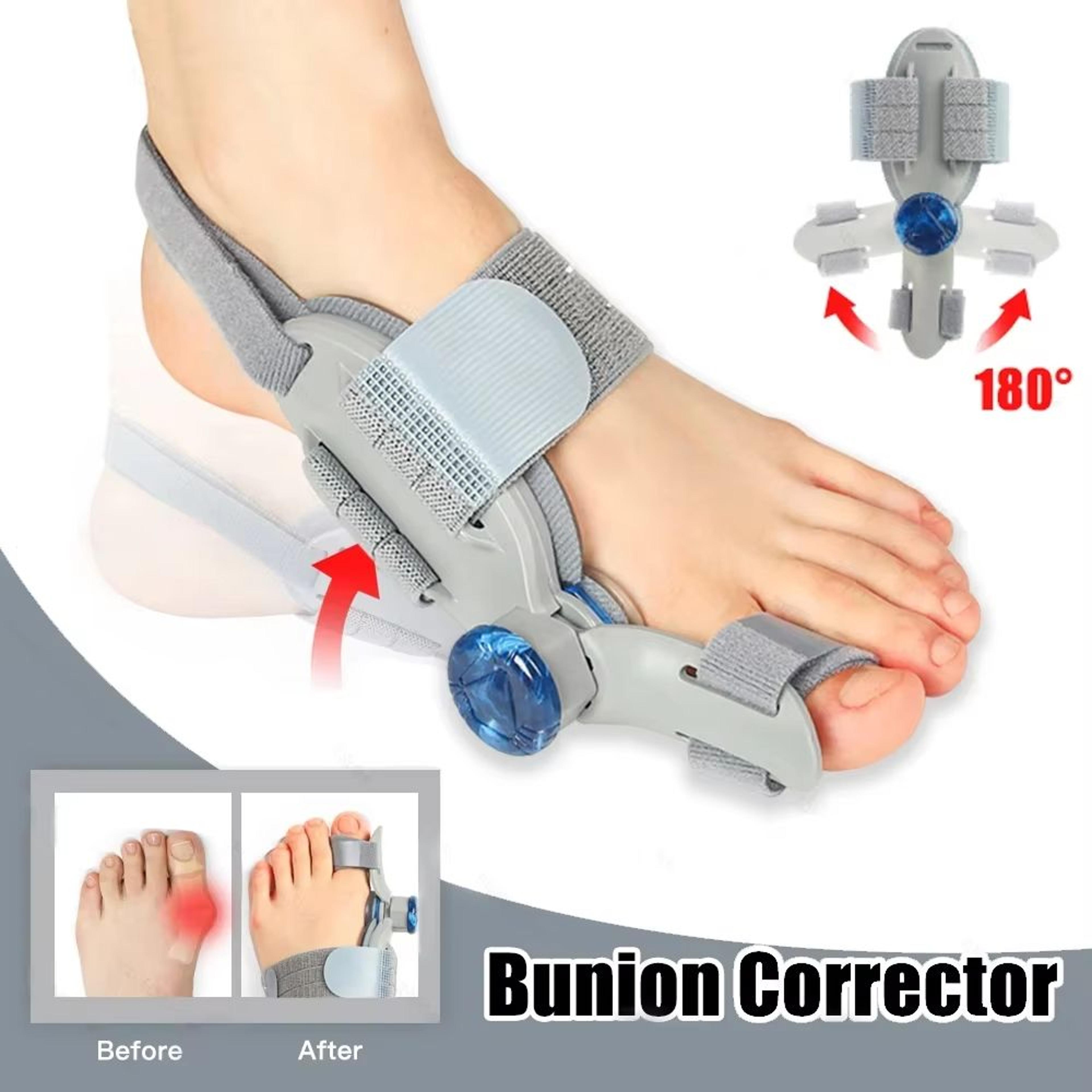 adjustable bunion corrector – big toe straightener and hallux valgus support with rotating alignment