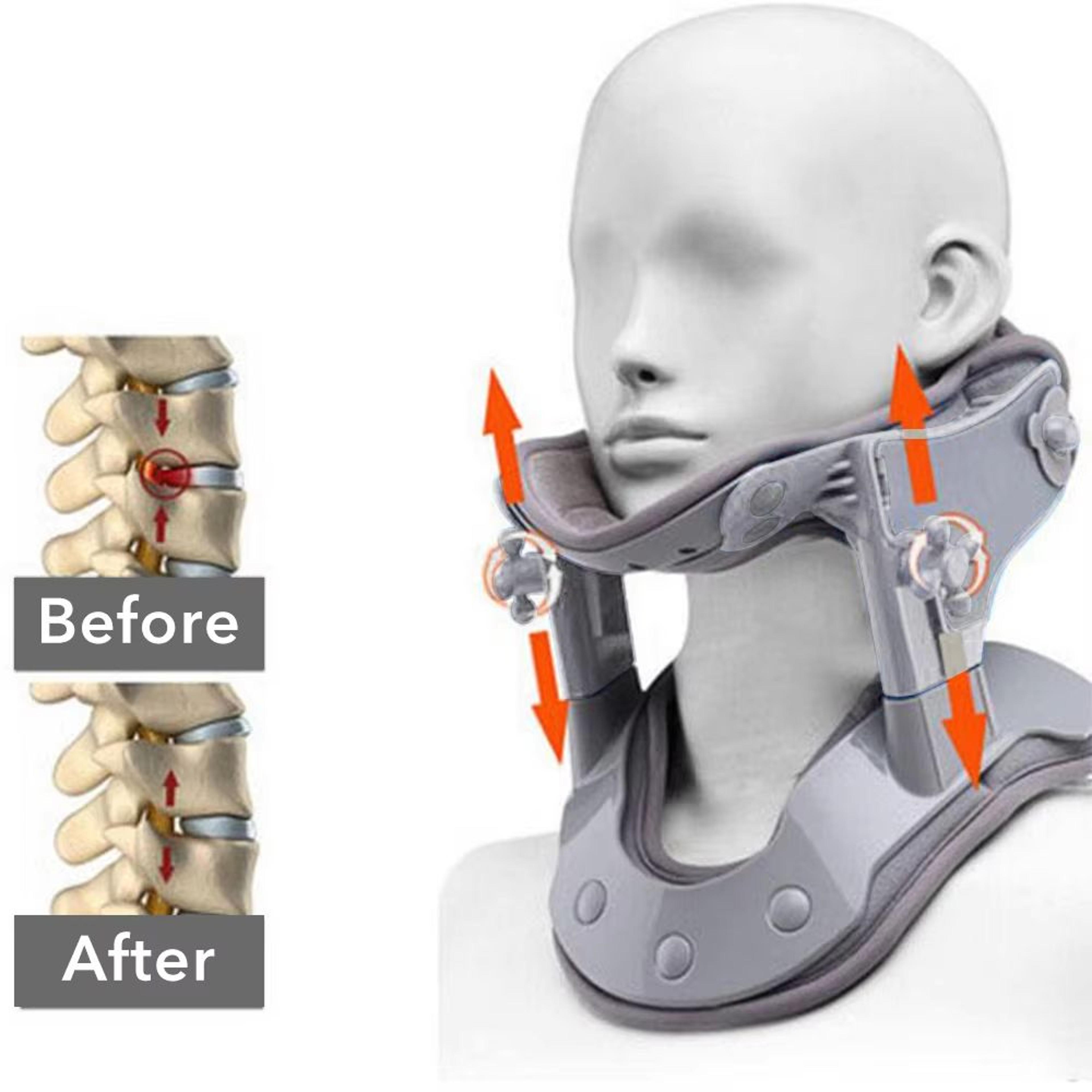 cervirelief inflatable neck traction kit