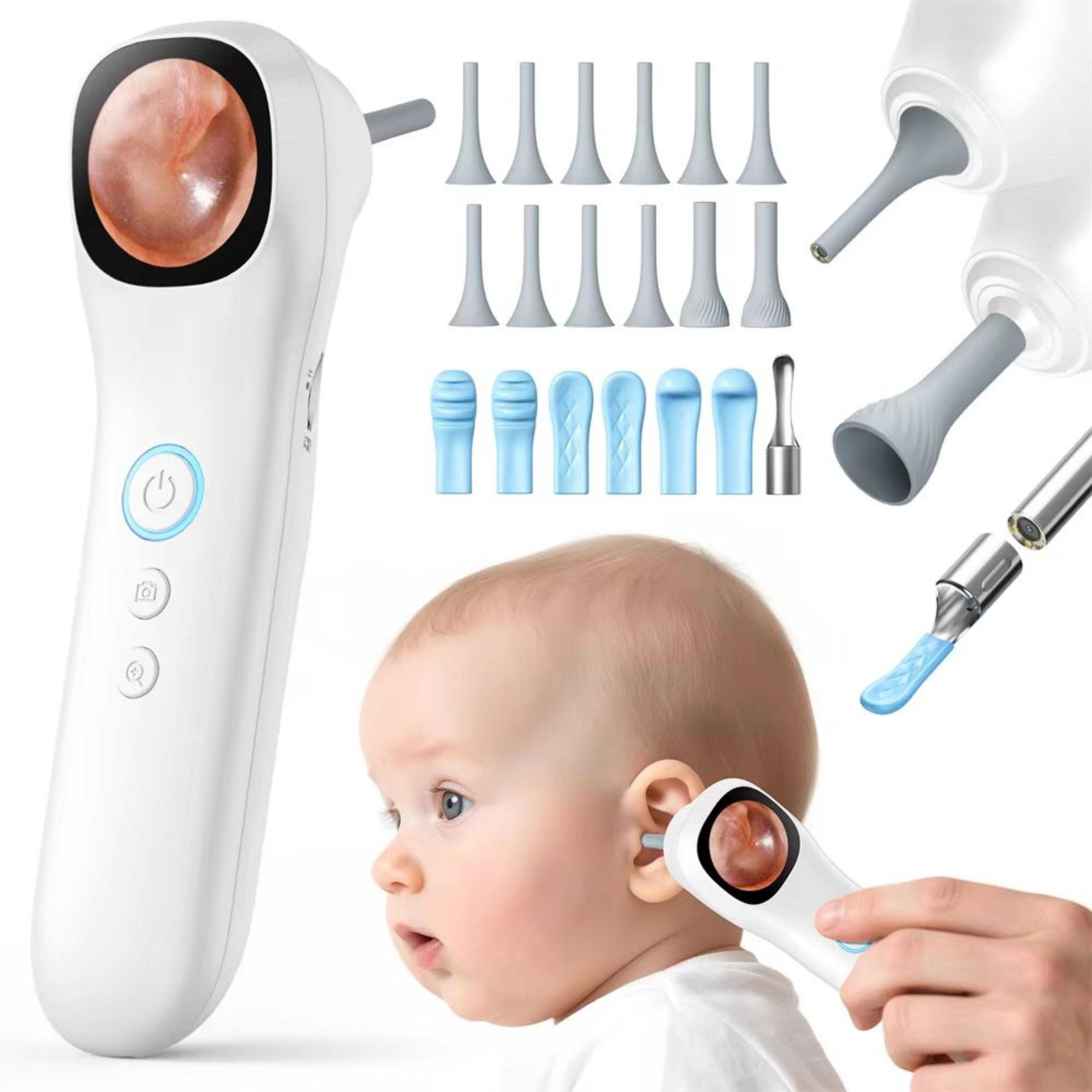 hd visual ear camera monitor – 1.21inch ips screen smart otoscope for ear, nose, mouth, skin & pets