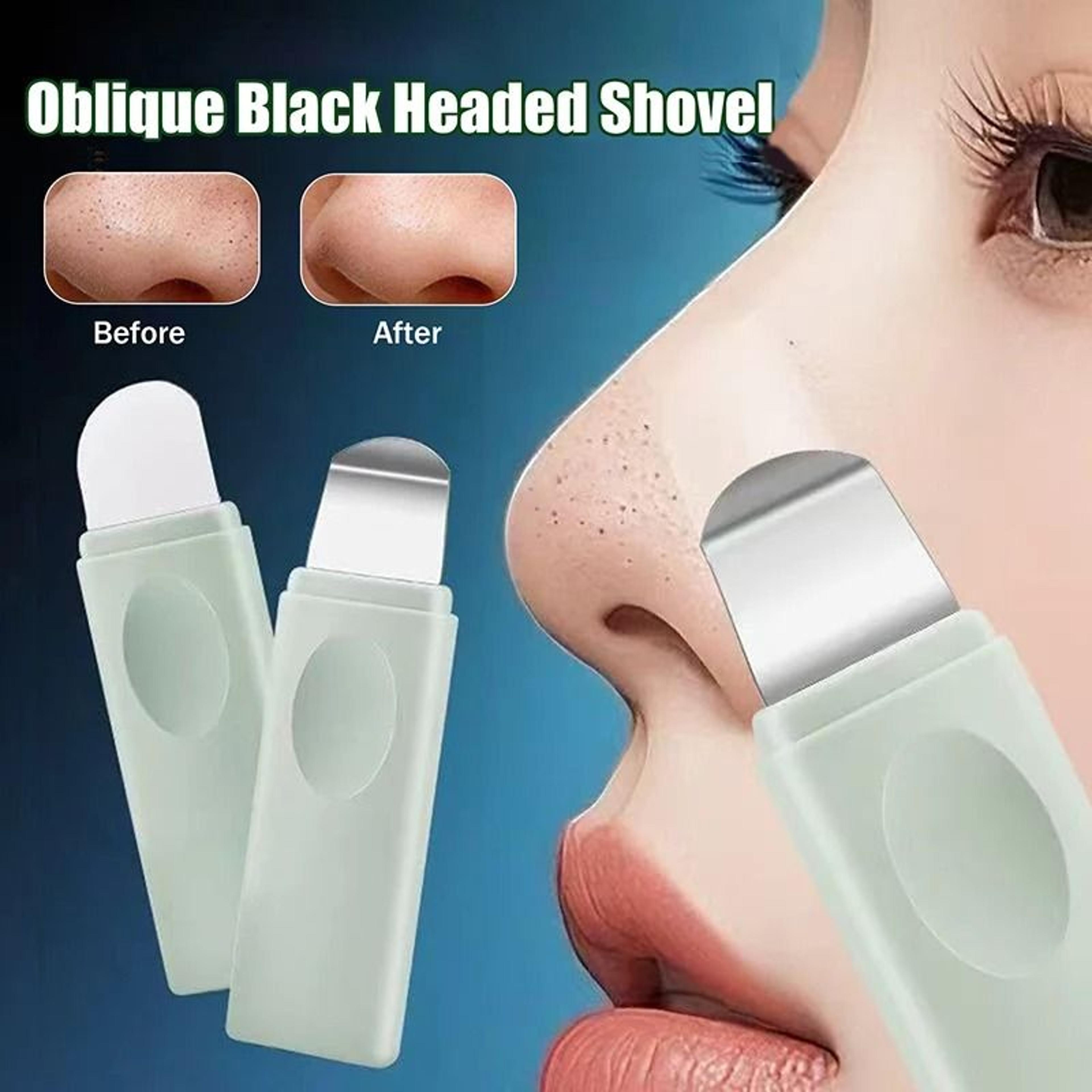 manual blackhead & whitehead remover tool for deep pore cleansing