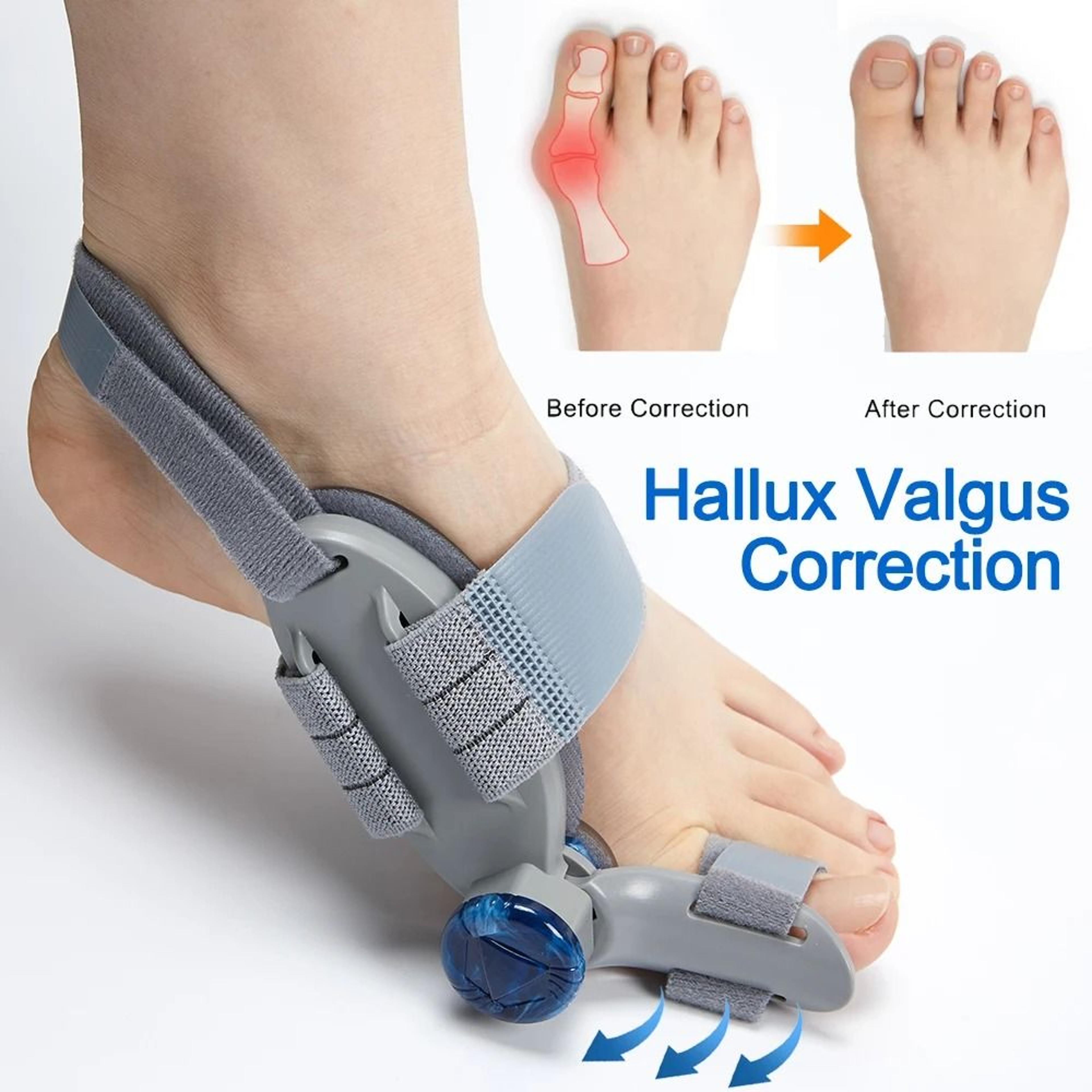 bunion splint big toe straightener orthopedic foot corrector for hallux valgus pain relief