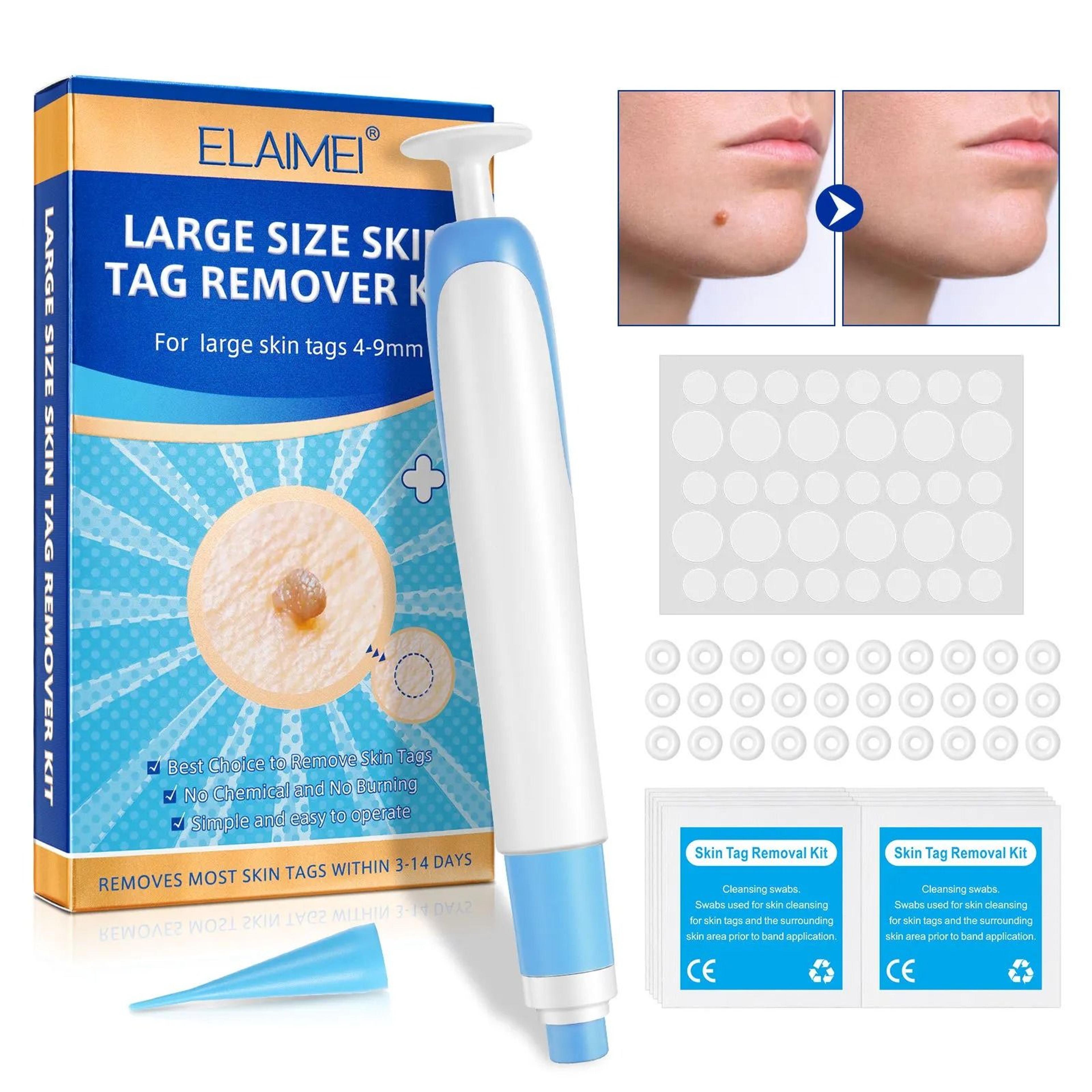 auto large size skin tag removal kit for 4 to 9mm skin tags with cleansing swabs home skin care tool
