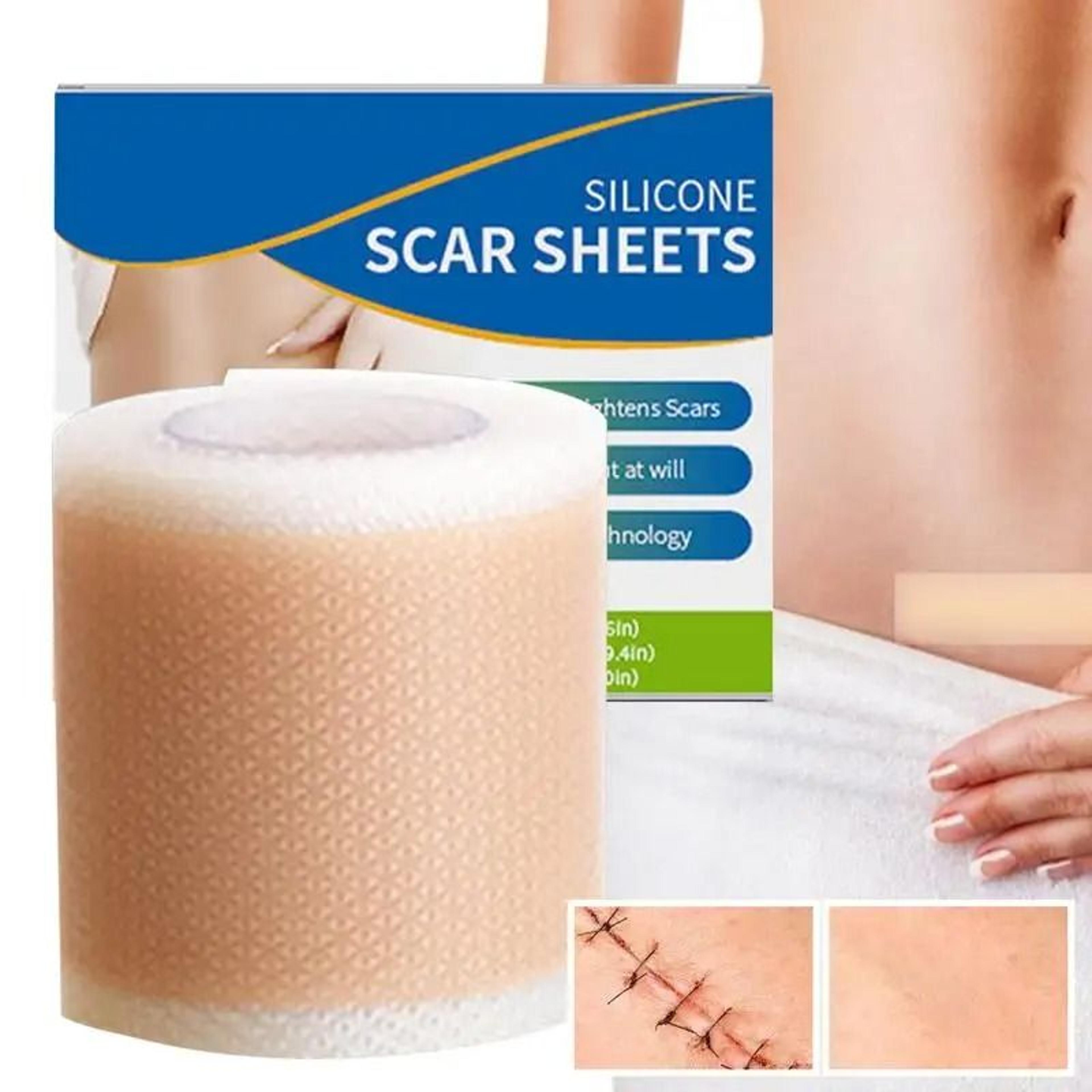 soft reusable silicone scar tape for gentle scar care