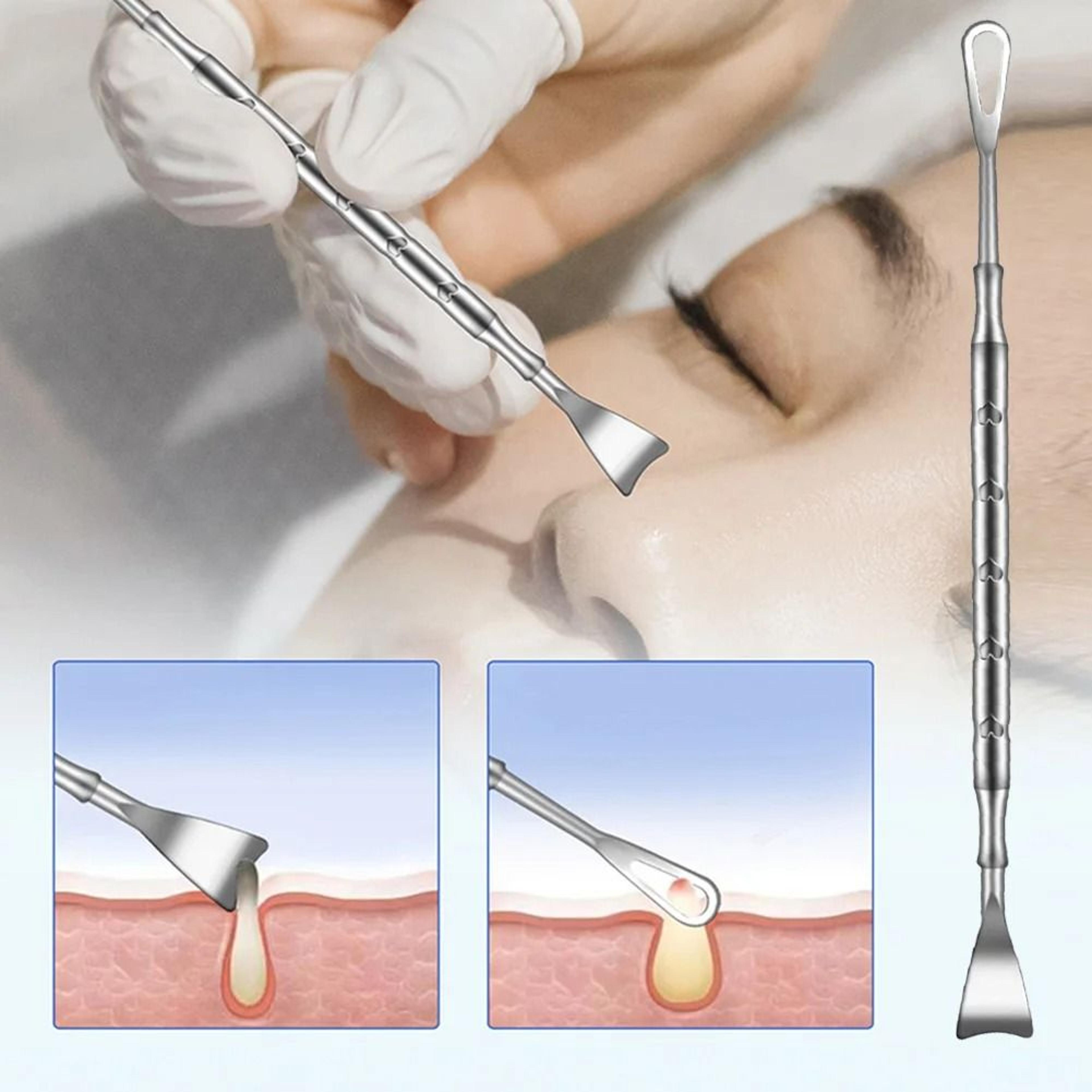 double ended stainless steel blackhead and acne removal needle for facial cleaning