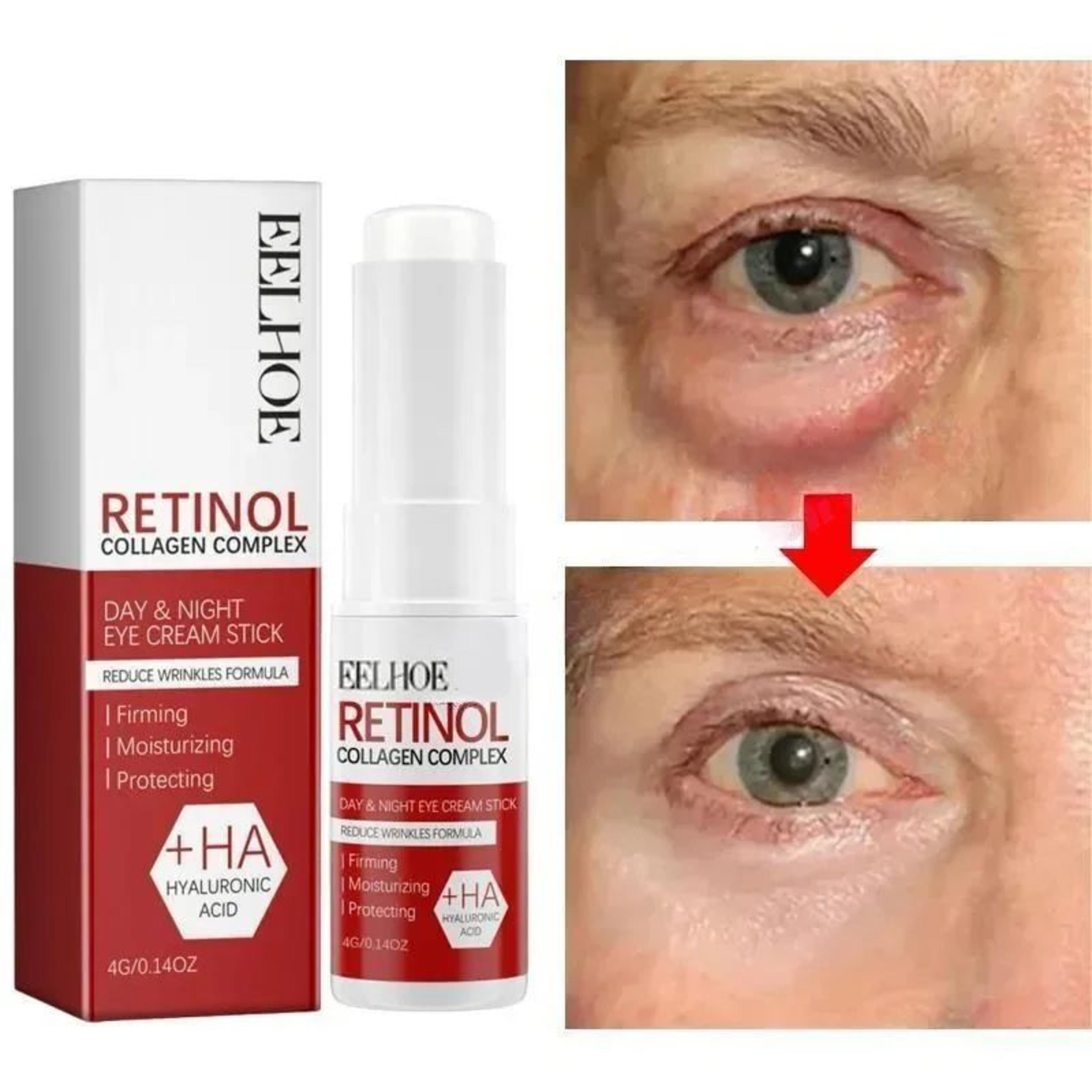 instant eye bag removal cream, reduce puffiness & dark circles, firm & brighten