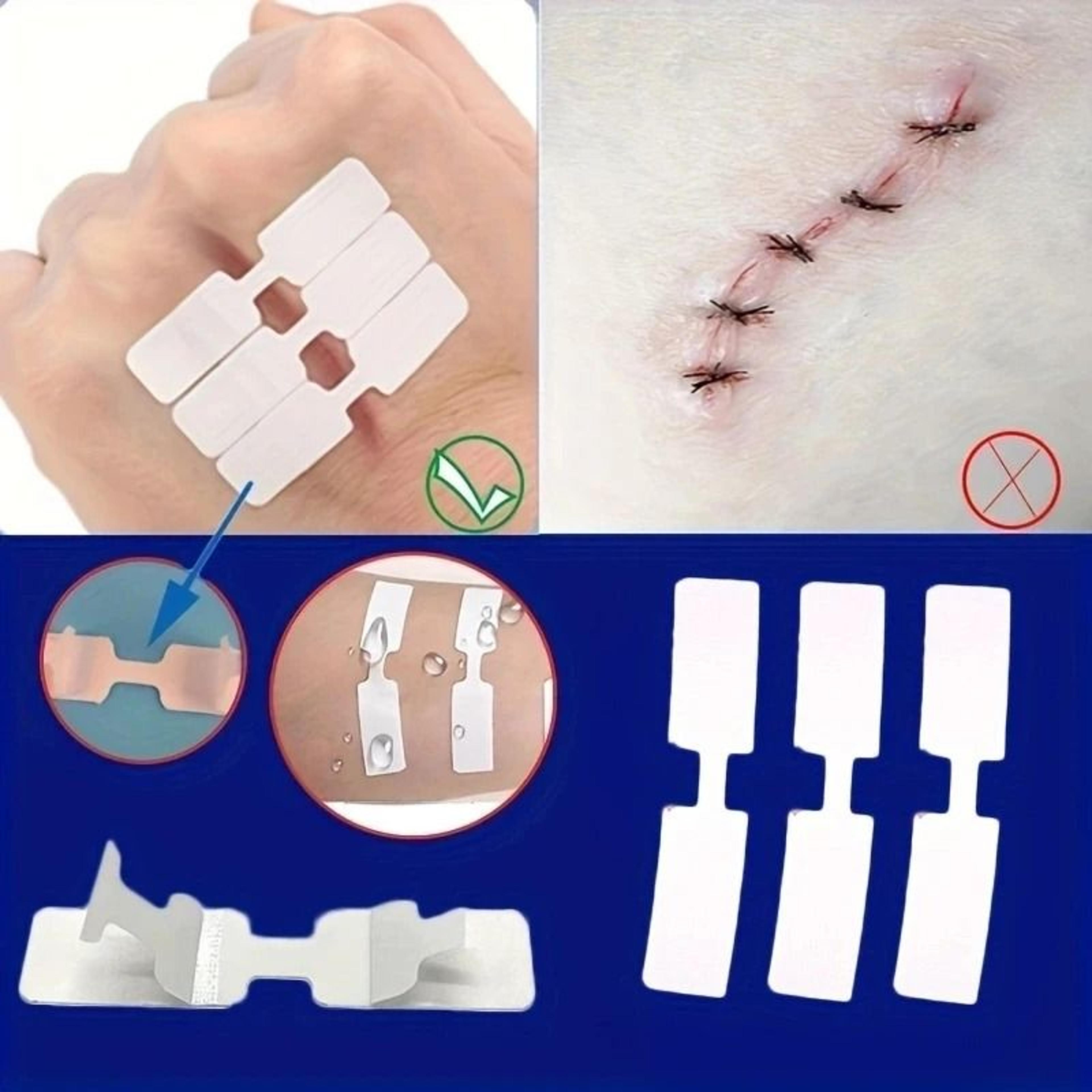 5-piece outdoor quick suture patch and emergency wound adhesive tape kit