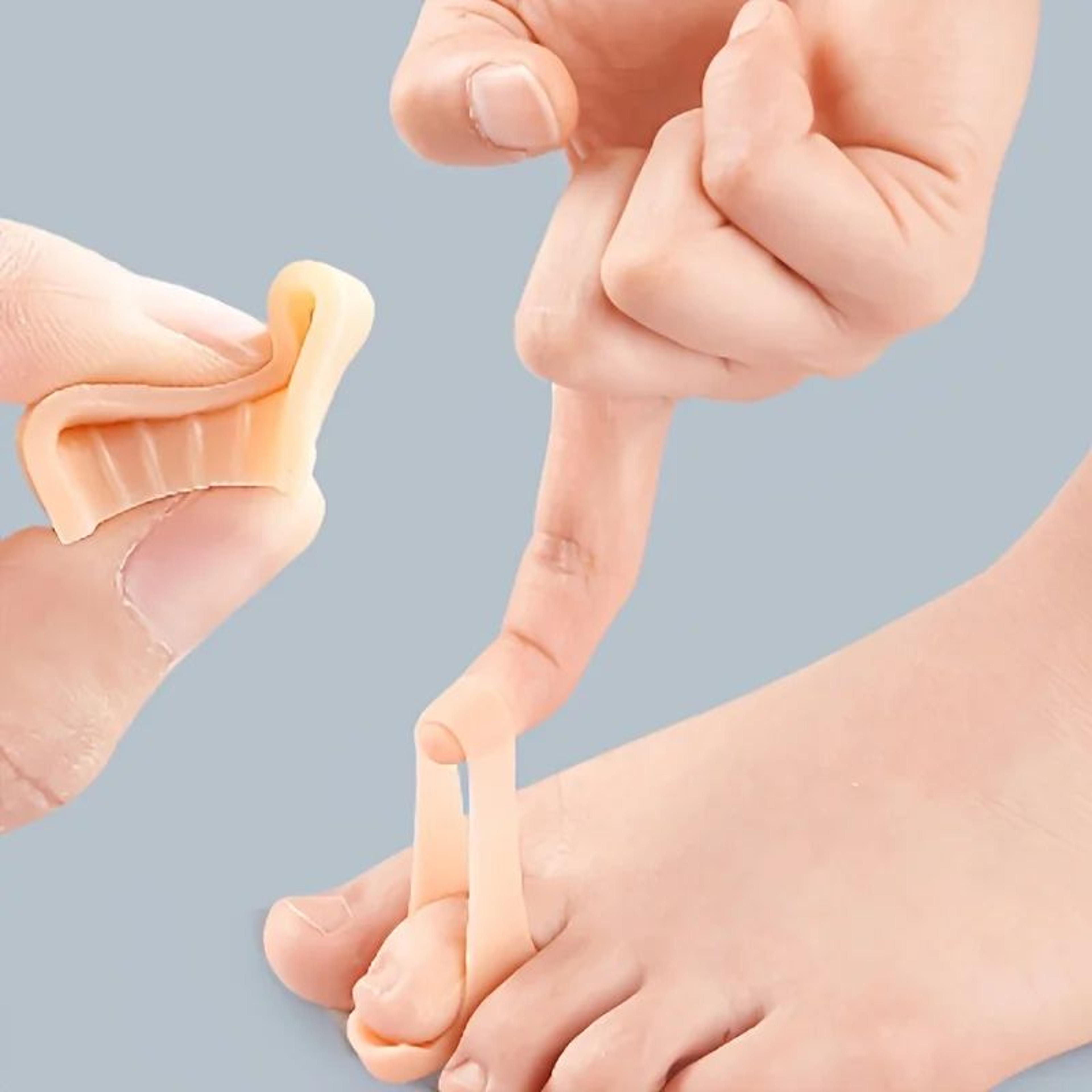 2-piece hammer toe corrector set – toe straightener pads for curling, bending & claw toe relief