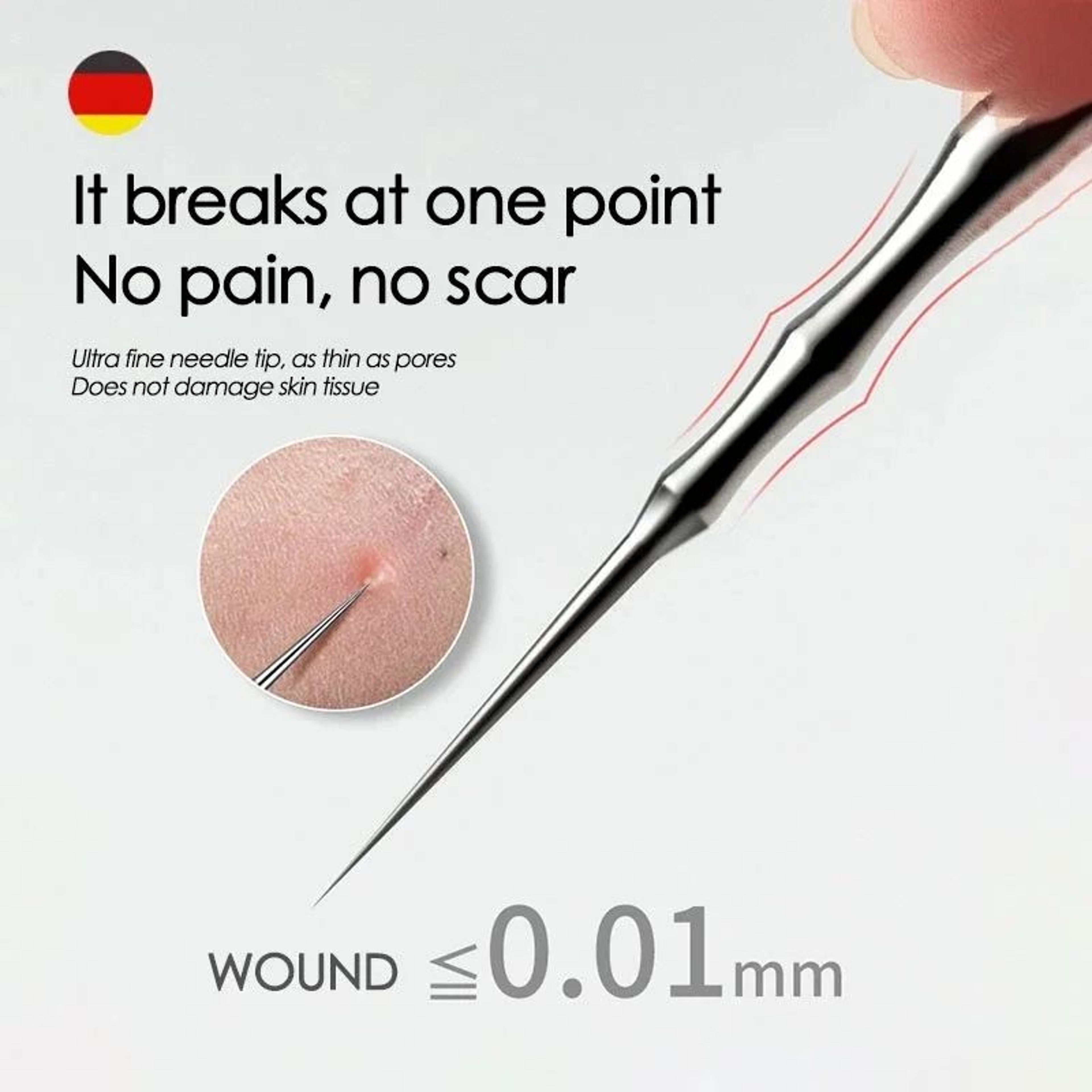 german acne blackhead removal tool – stainless steel pimple popper needle & tweezers extractor for whiteheads & blemishe