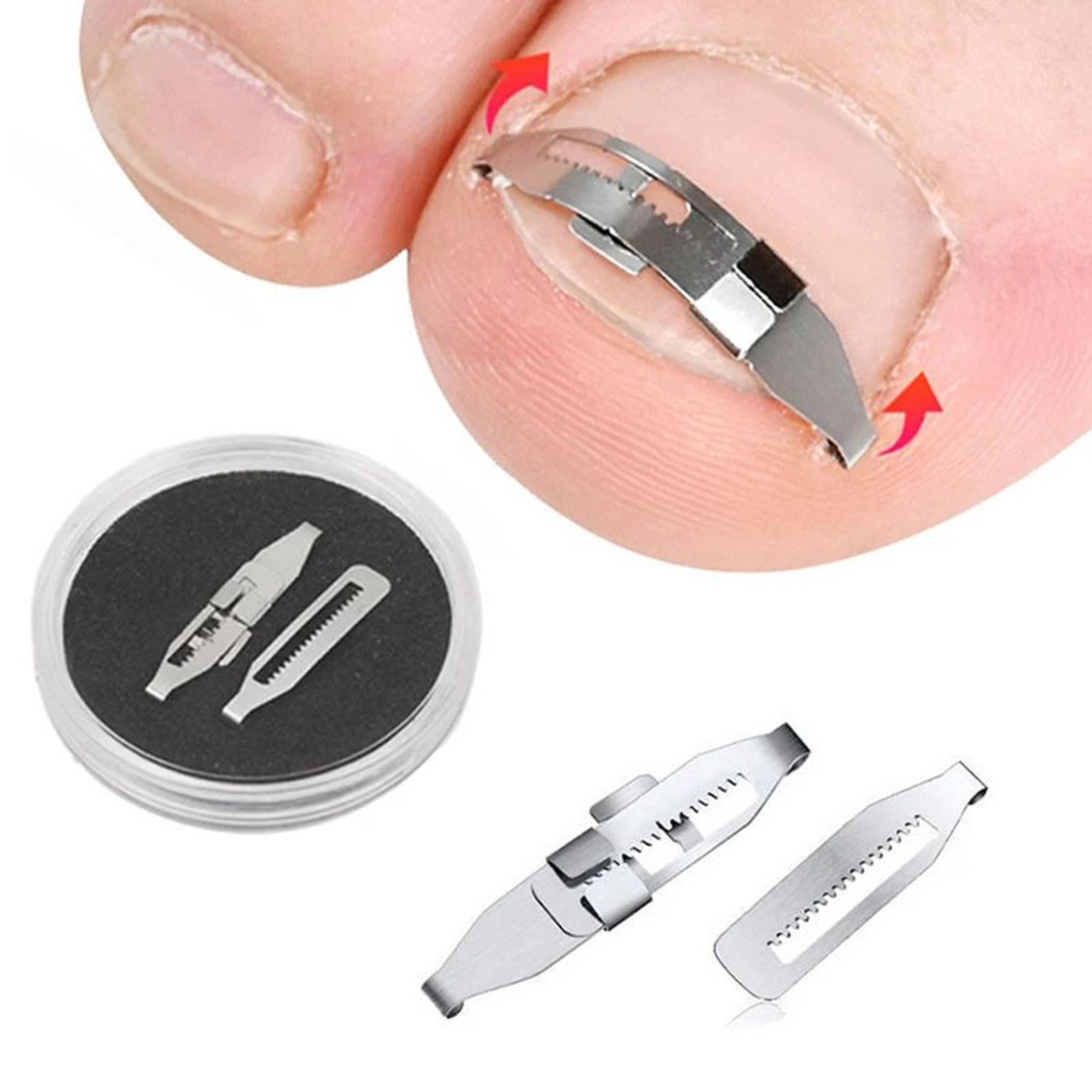professional ingrown toenail corrector tool foot care pedicure treatment