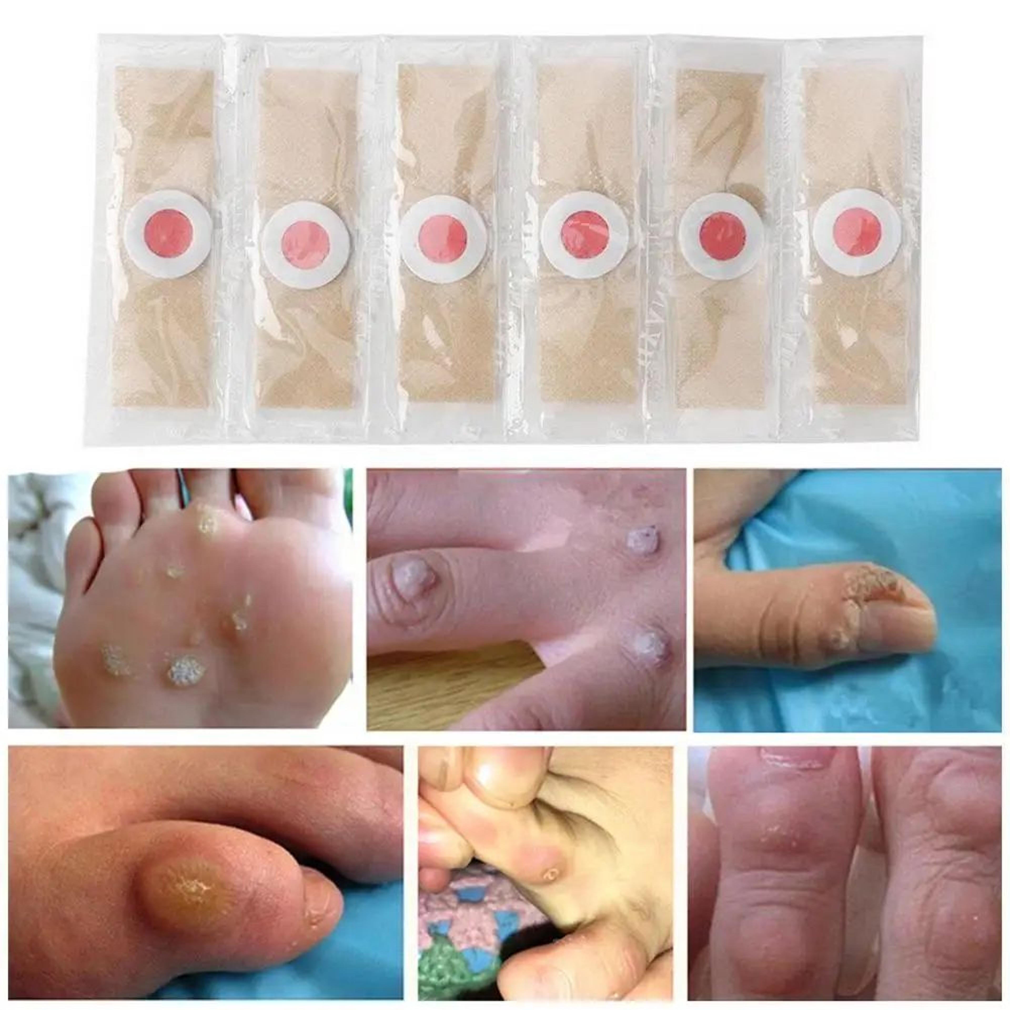 6 pcs foot corn and callus protector pads