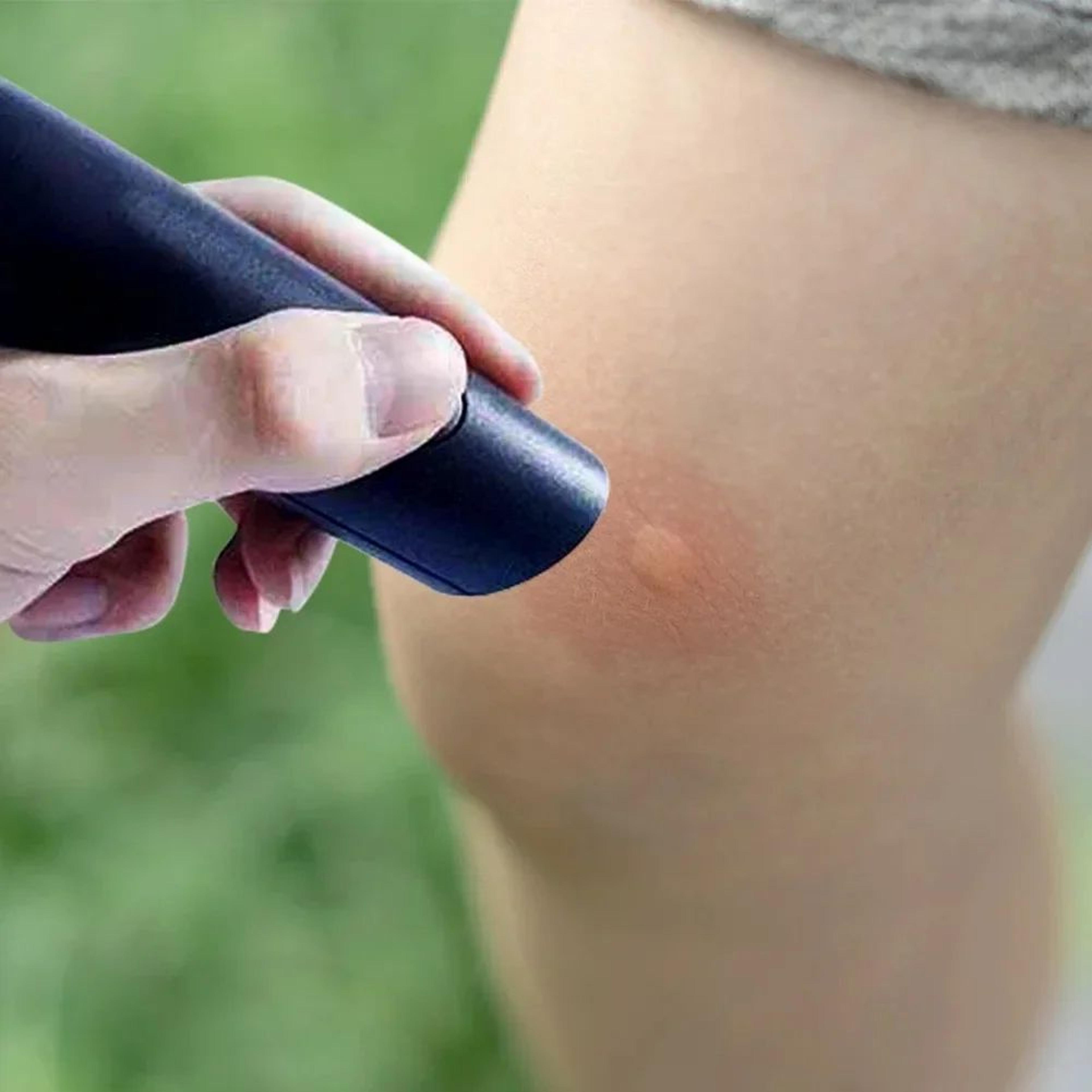 electronic mosquito bite relief pen portable anti itch tool