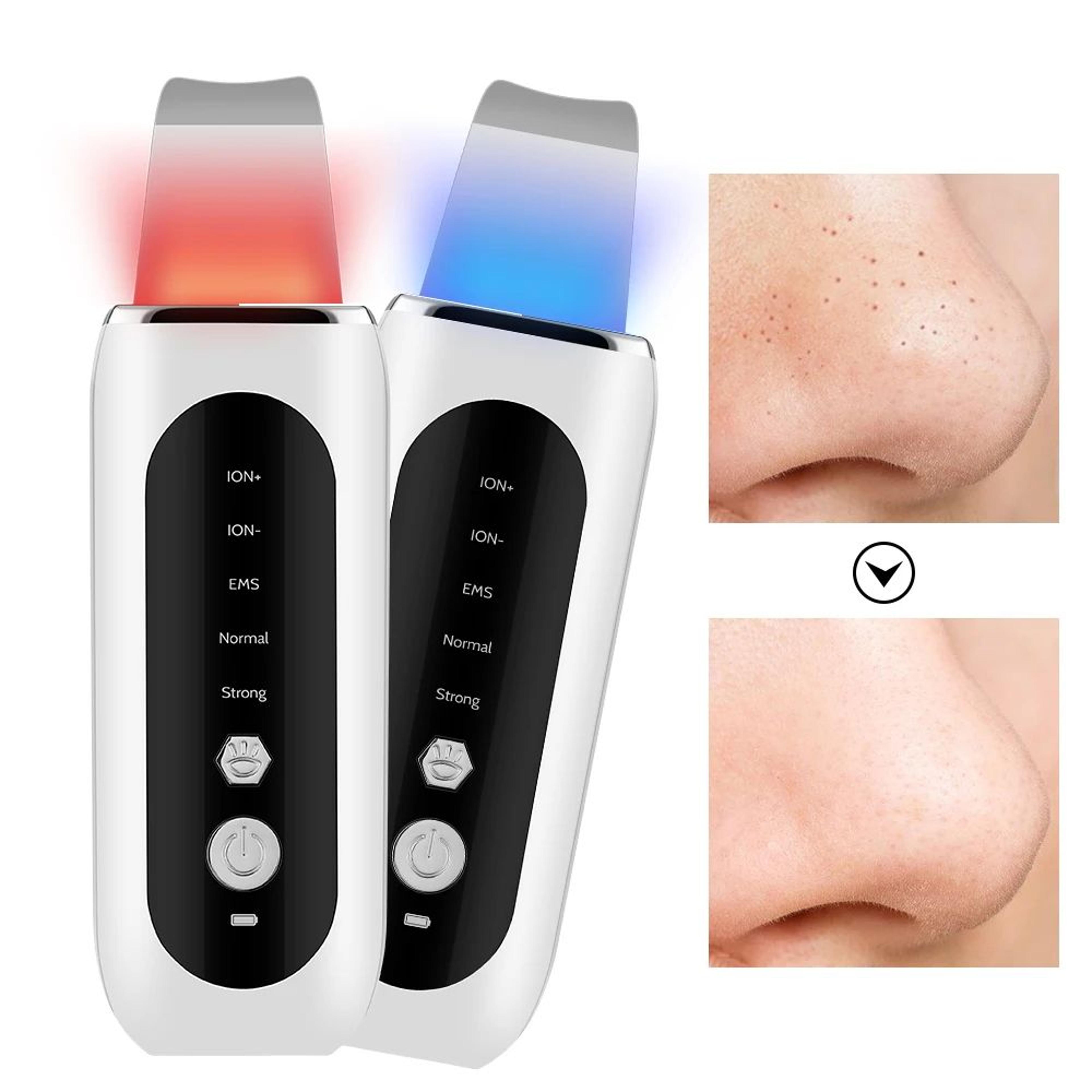 ultrasonic skin scrubber blackhead remover and deep pore cleaner