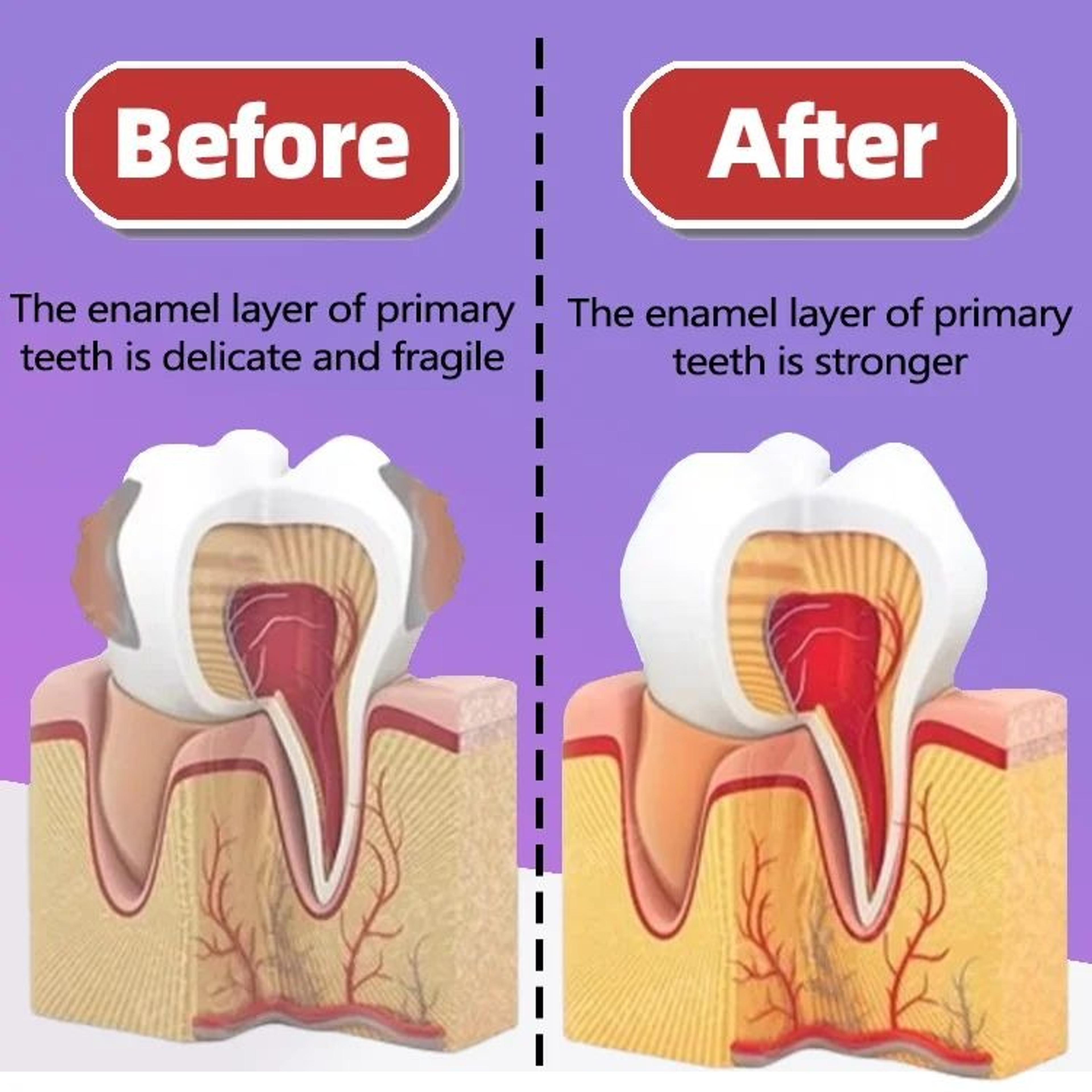 enamel care tooth repair gel for cavity and daily dental care