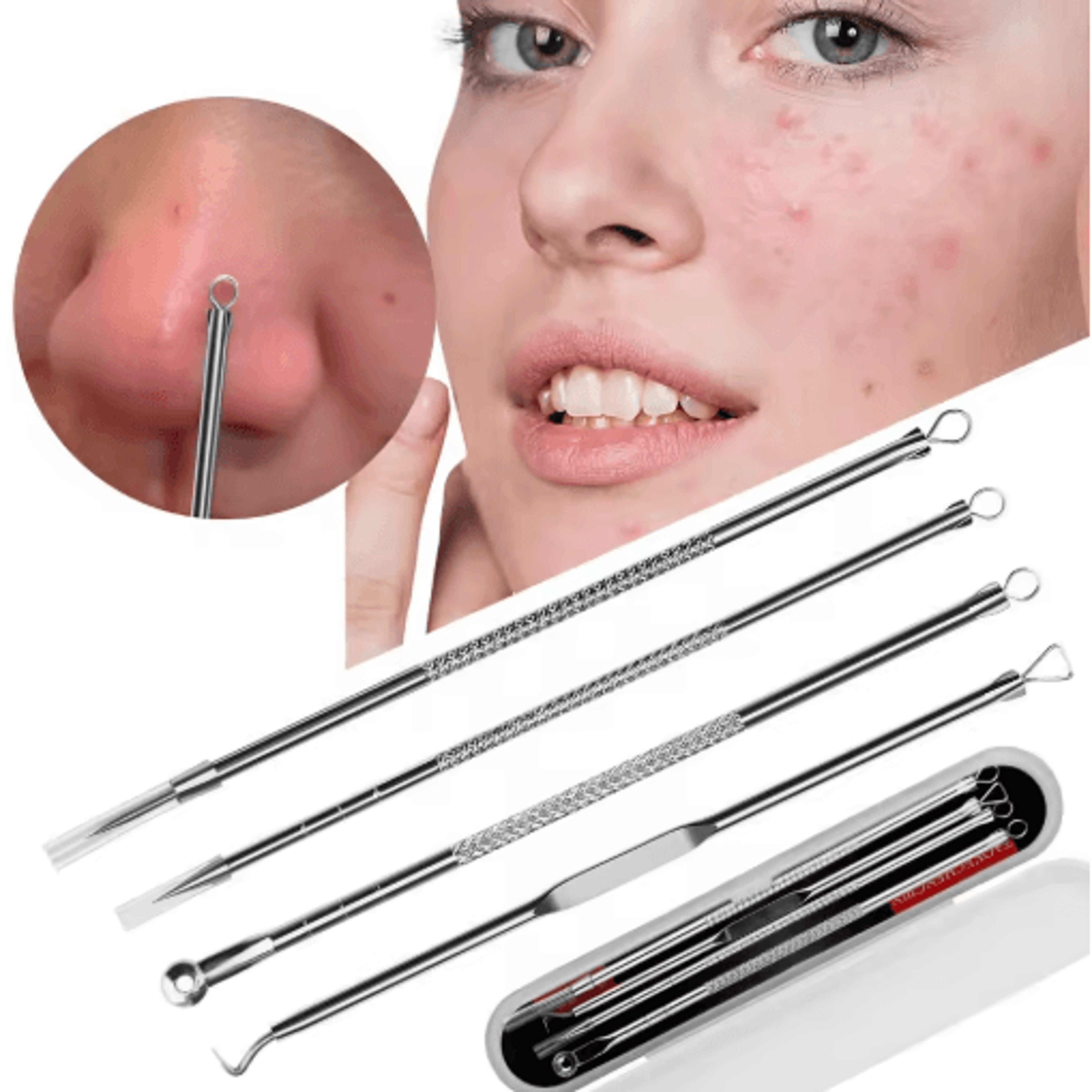 clearpoint ultra fine blackhead and pimple remover tweezers set
