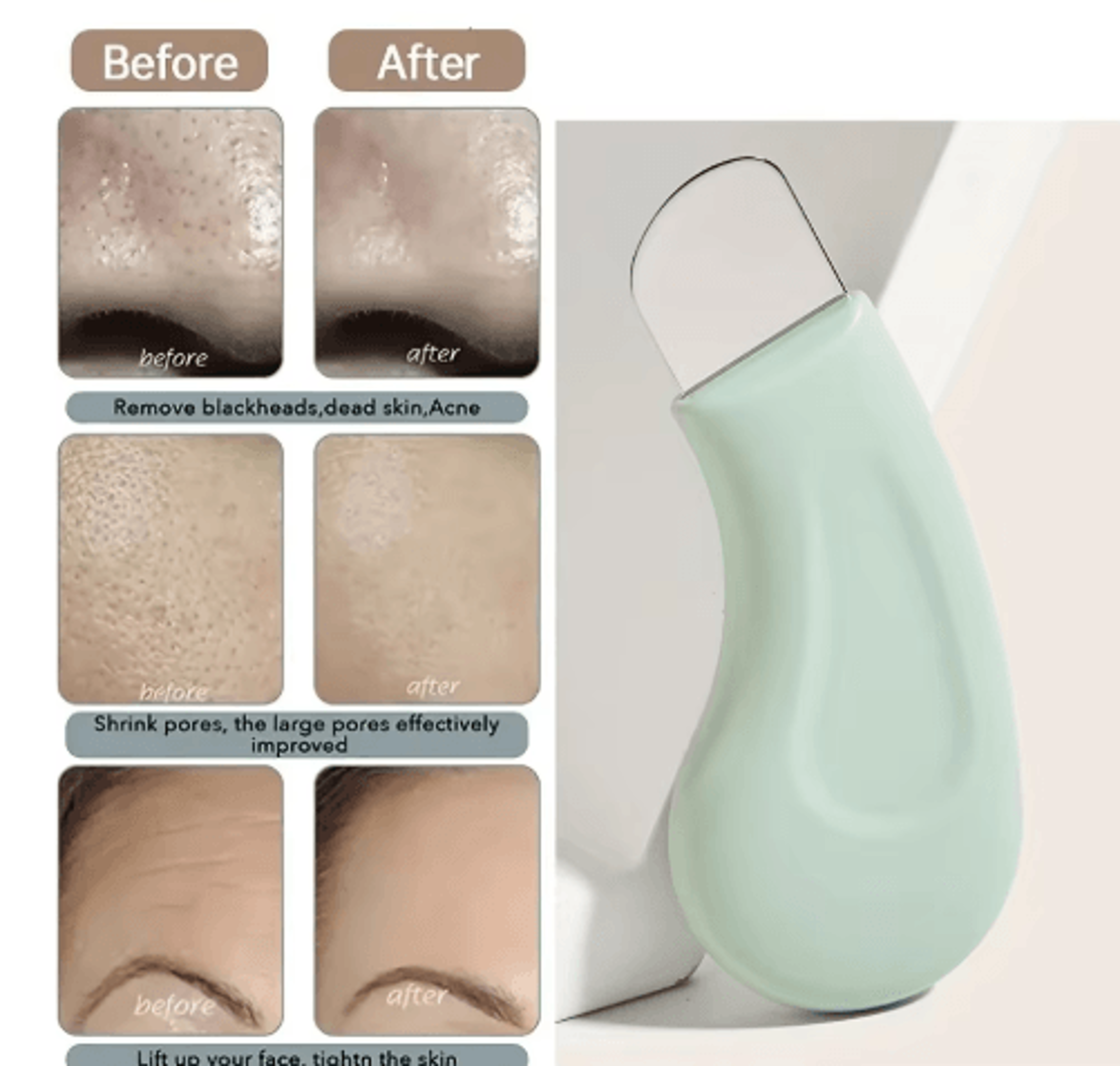 stainless steel blackhead removal tool for deep pore cleaning