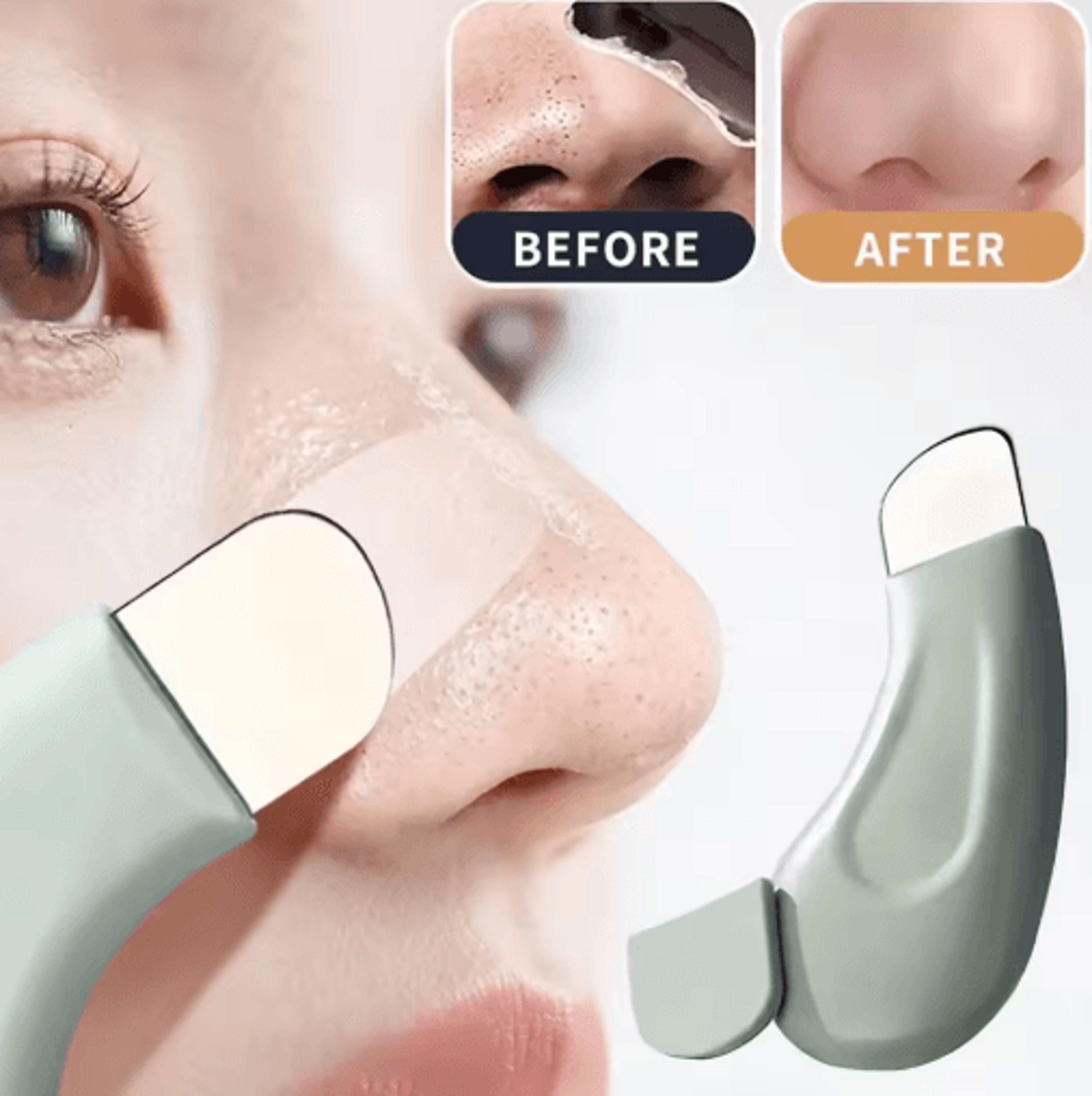deep cleansing blackhead & whitehead removal tool – precision pore cleaning kit