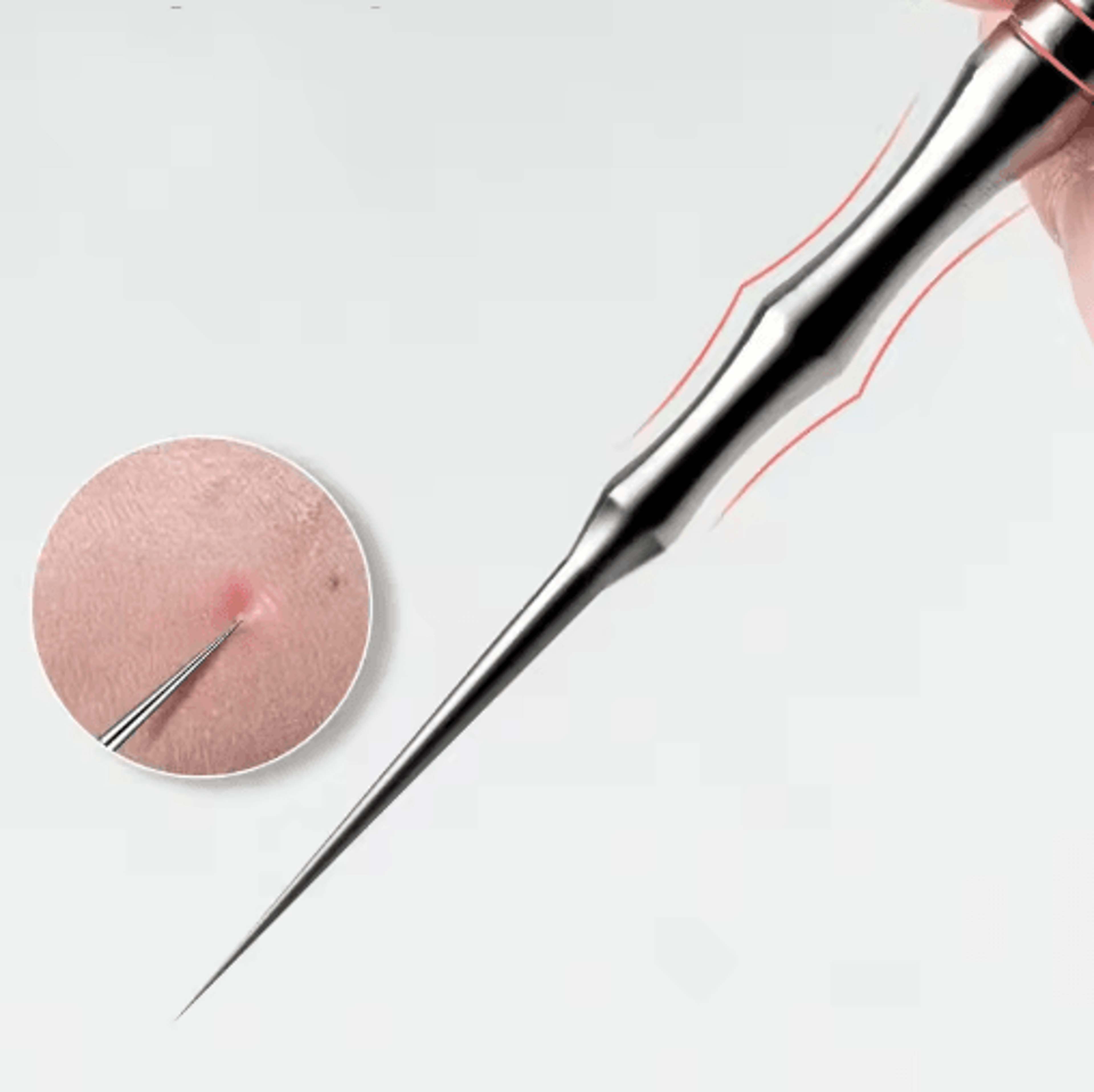 ultra-fine blackhead & whitehead removal tool – precision acne extractor for deep pore care