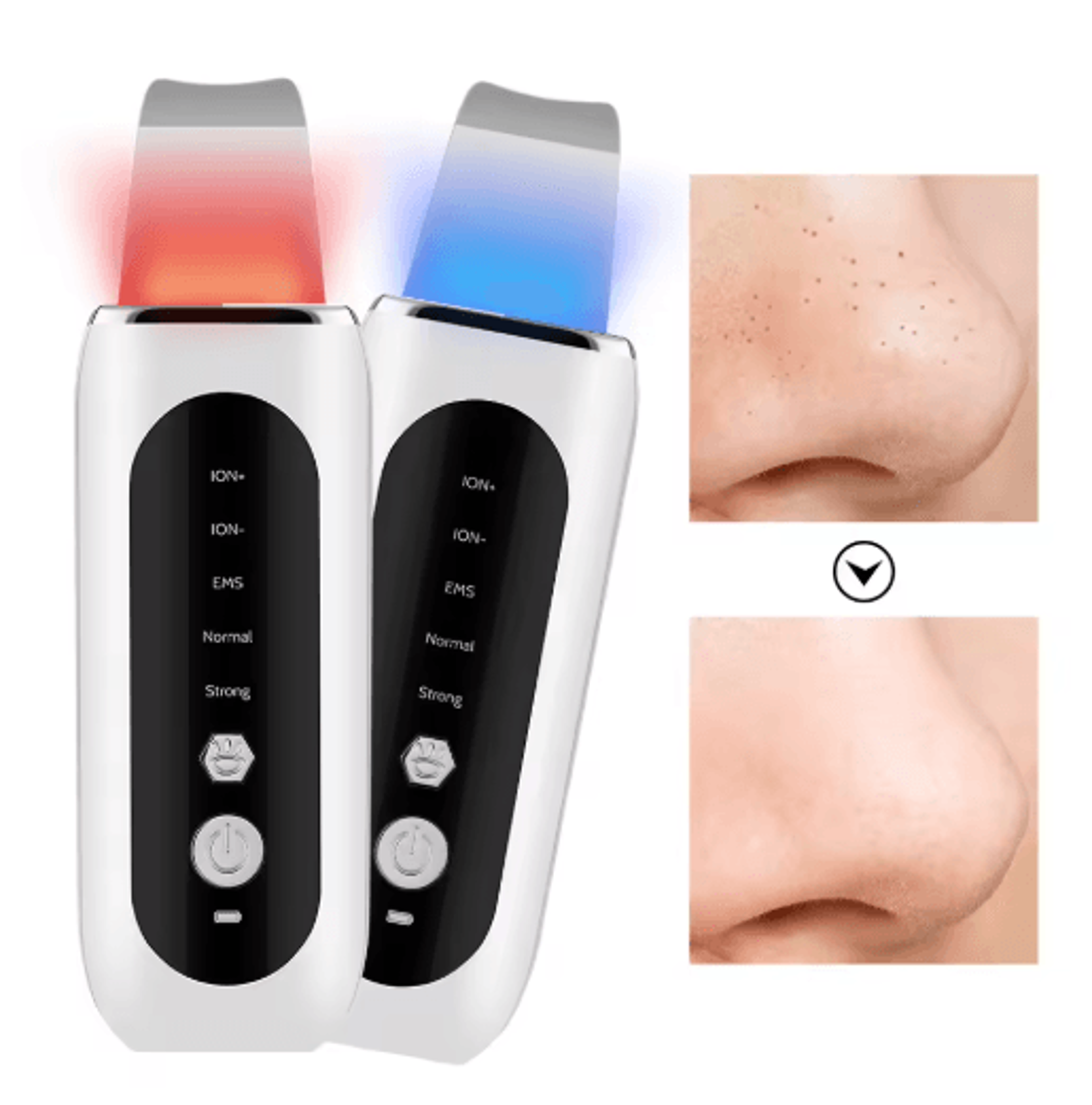 ultrasonic skin scrubber – deep cleansing blackhead remover & facial pore cleaner