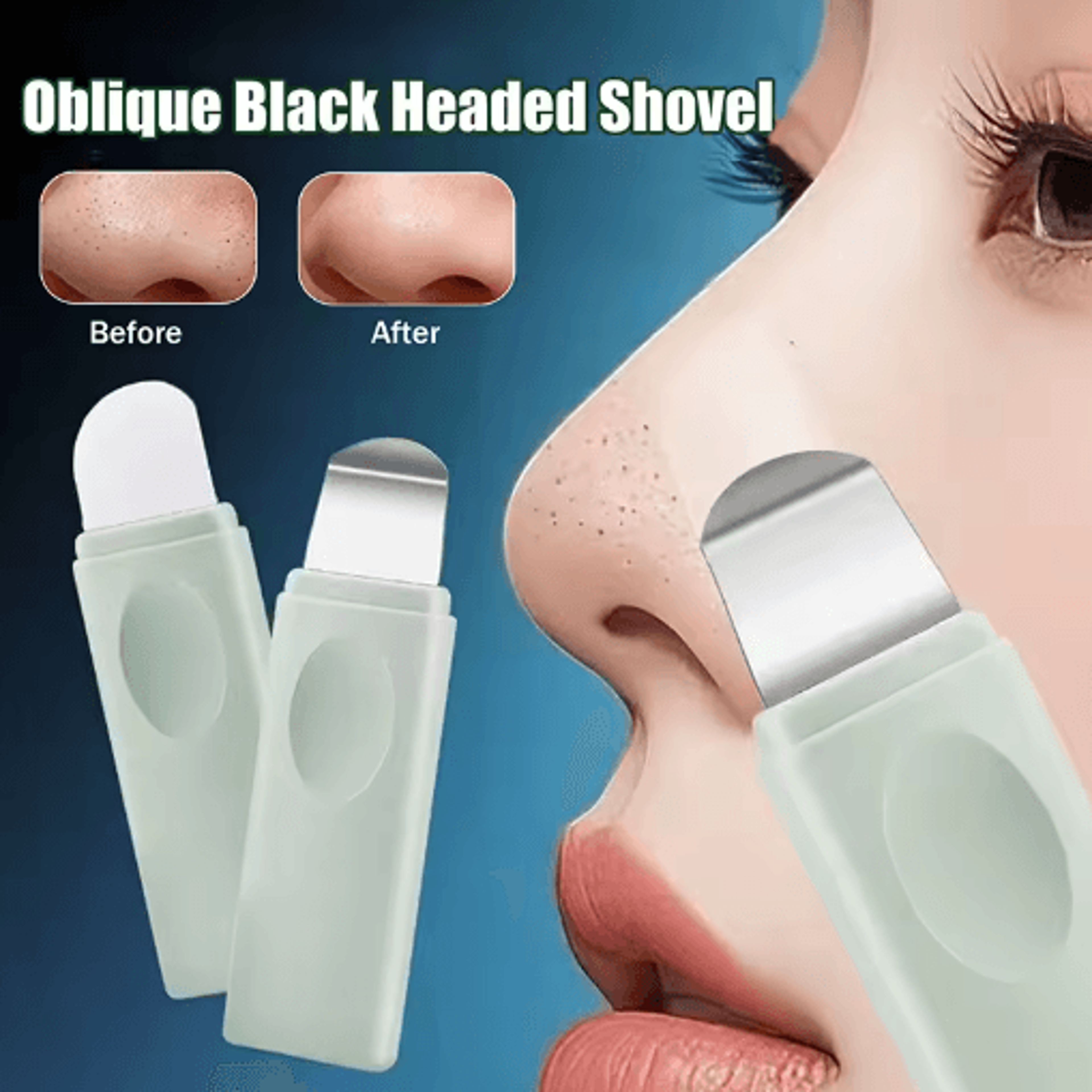 manual blackhead & whitehead removal tool – stainless steel skin pore cleaner