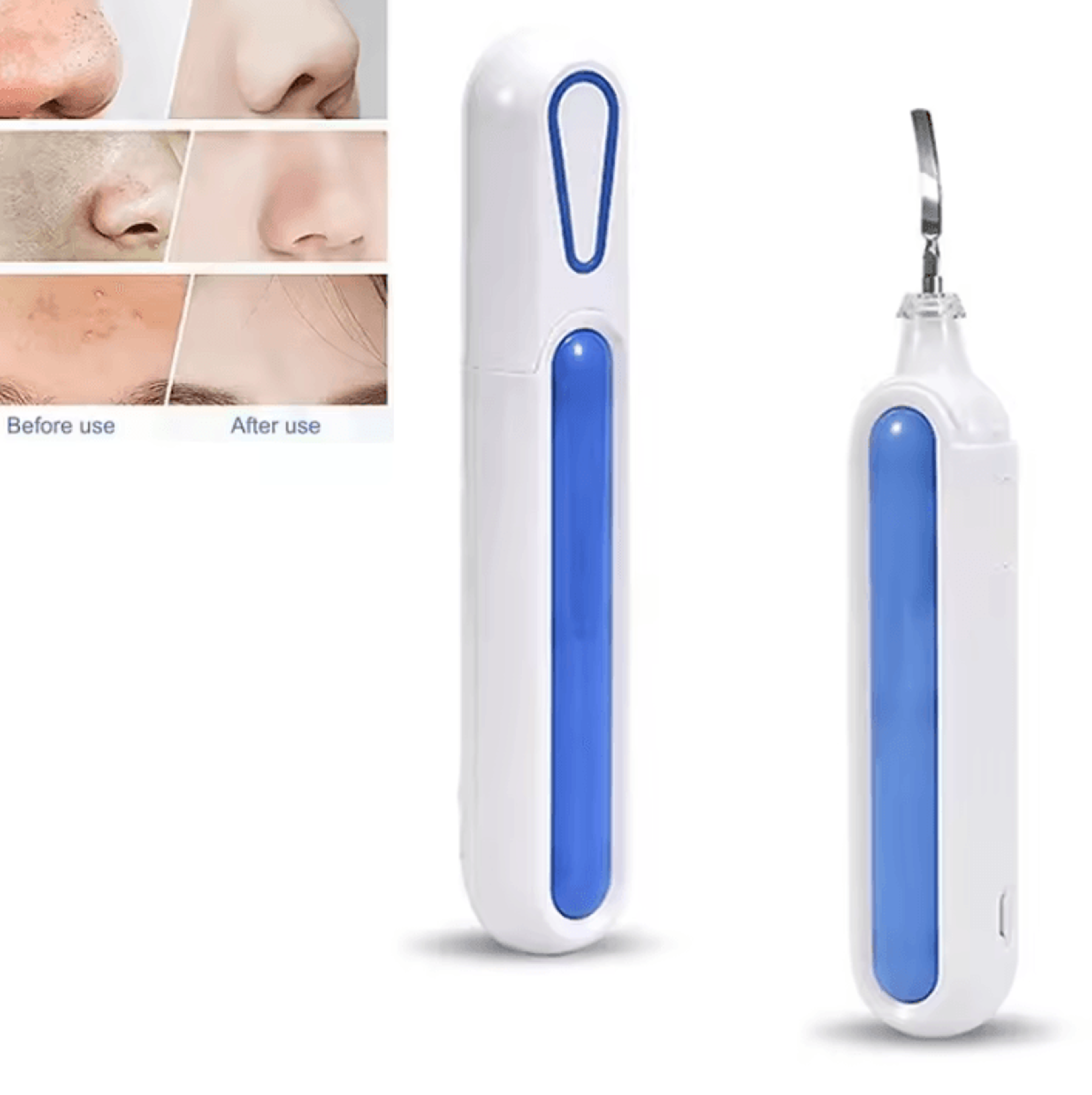 ultrasonic skin scrubber for deep cleansing and gentle facial exfoliation