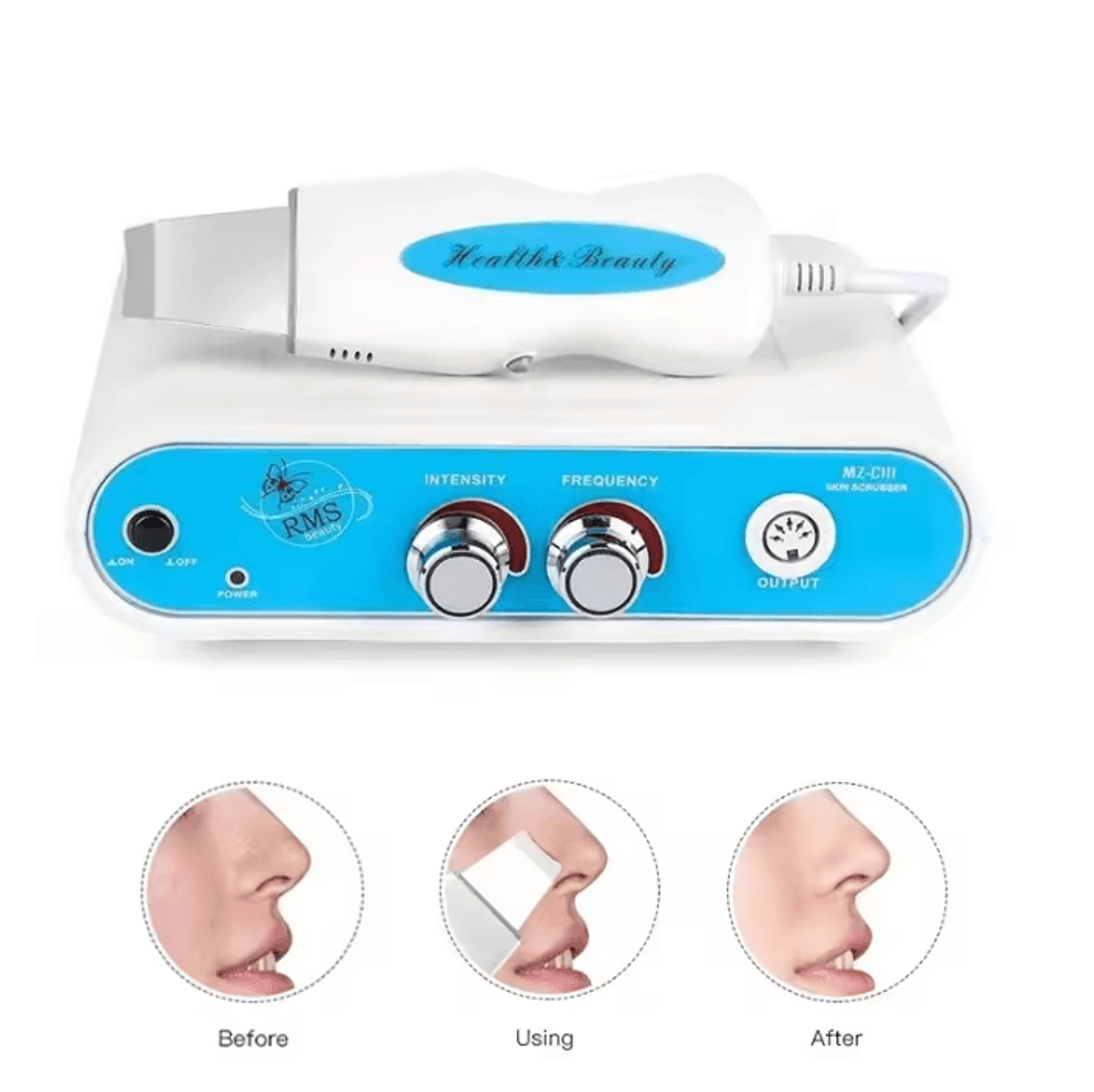 ultrasonic facial skin scrubber for deep cleansing and gentle exfoliation