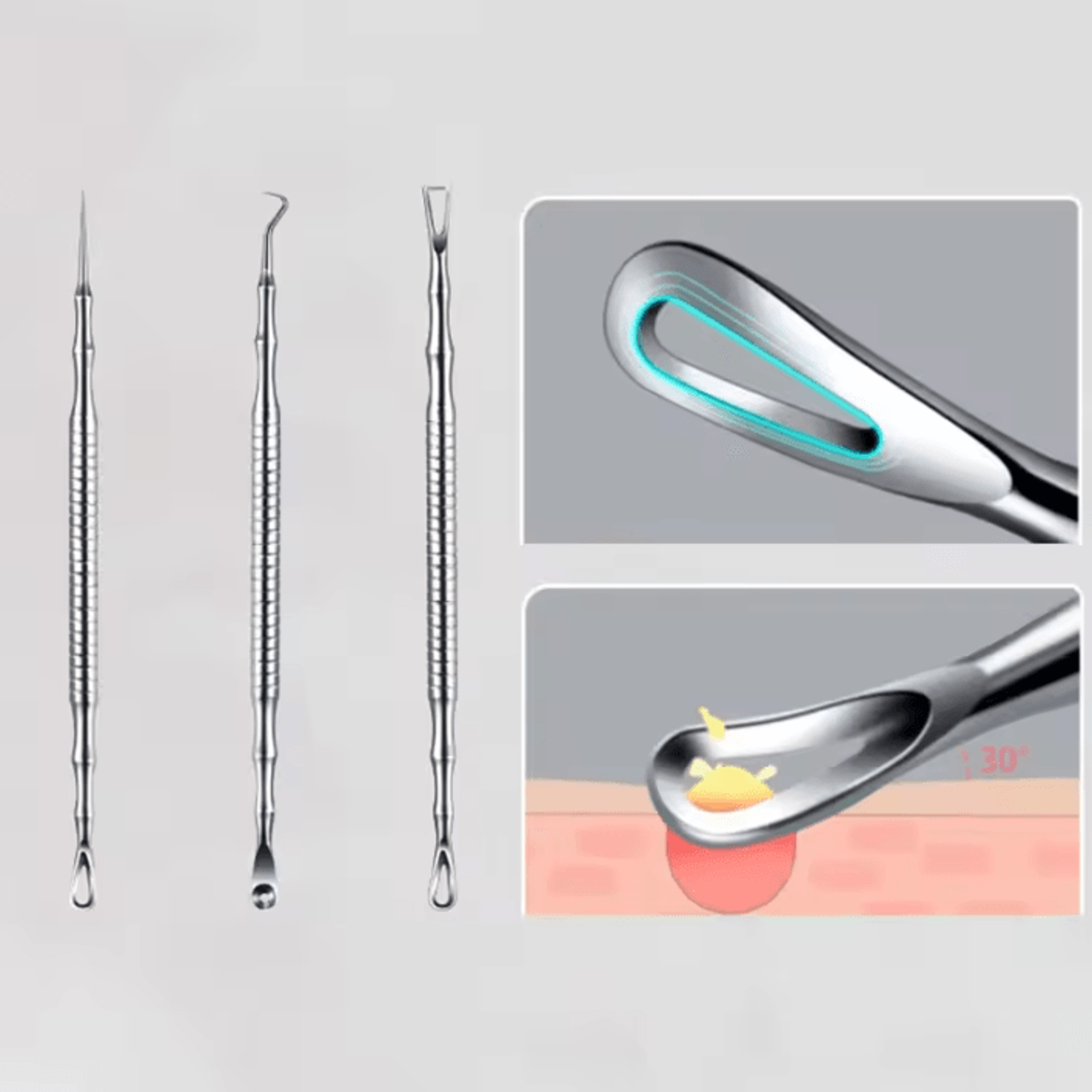 professional blackhead remover tool kit with milia extractor and blemish removal needles