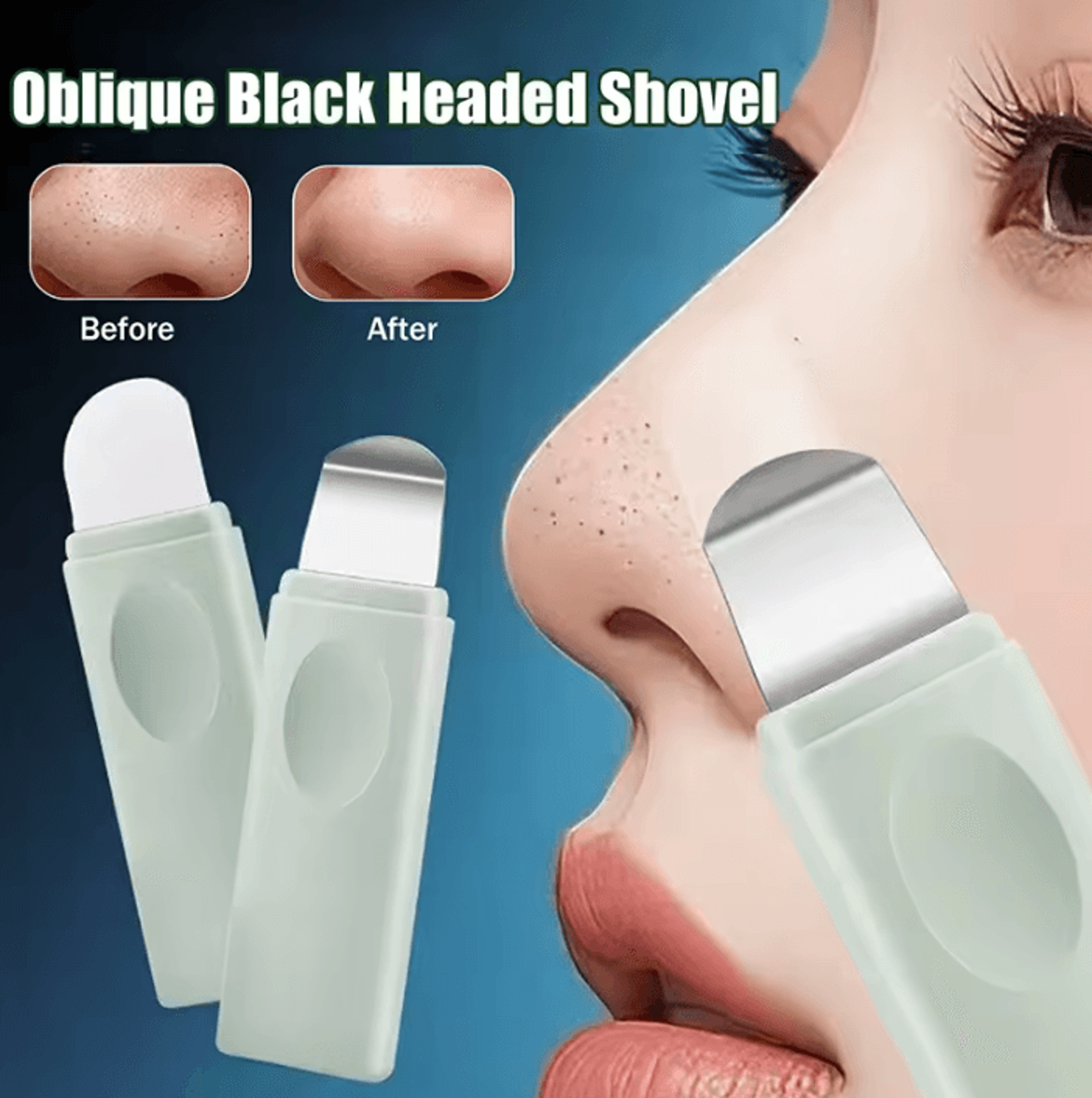 professional blackhead remover tool stainless steel pore cleaner for blackheads and whiteheads