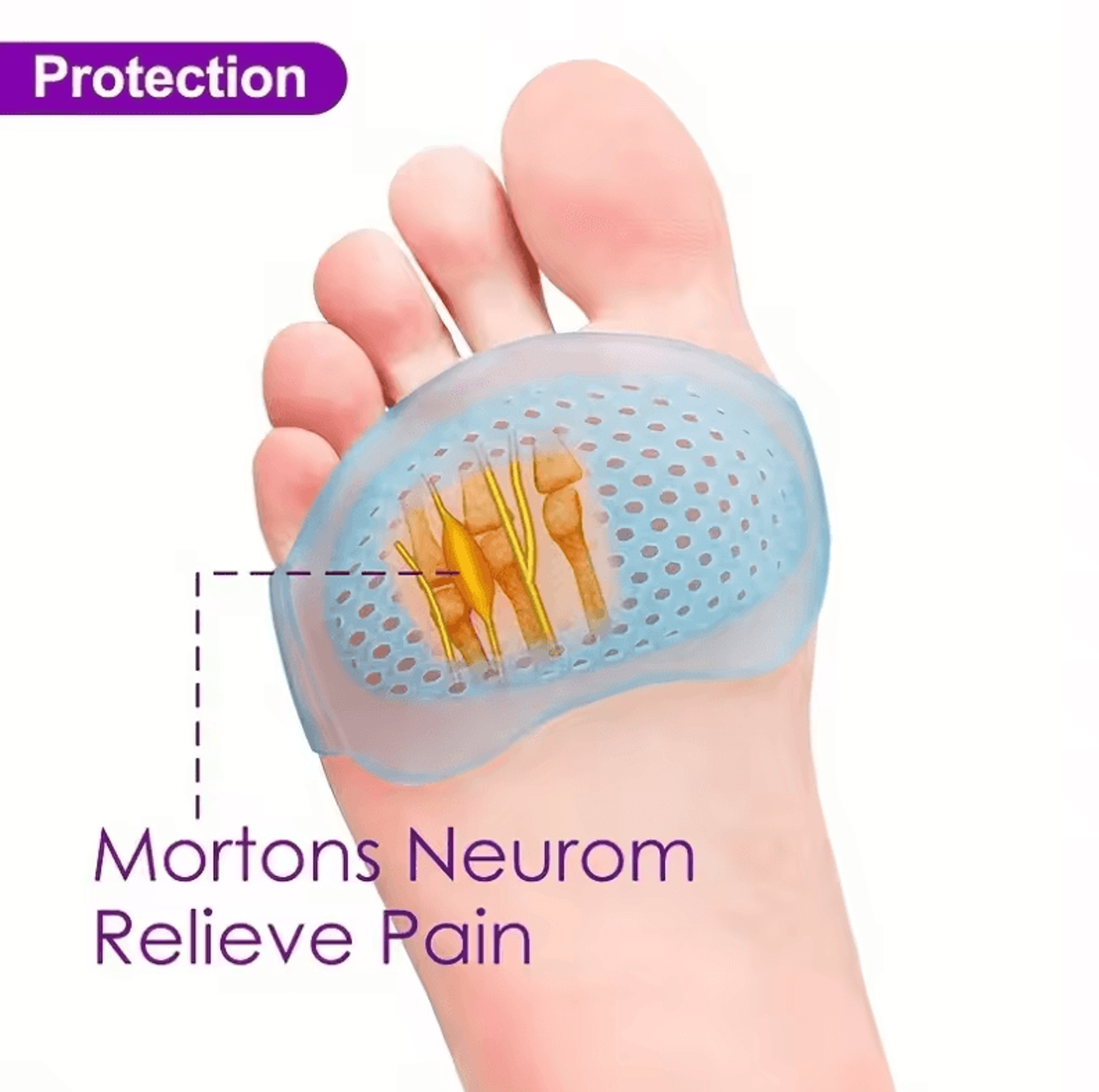 silicone metatarsal pads for arch support & pain relief – gel cushions for running comfort