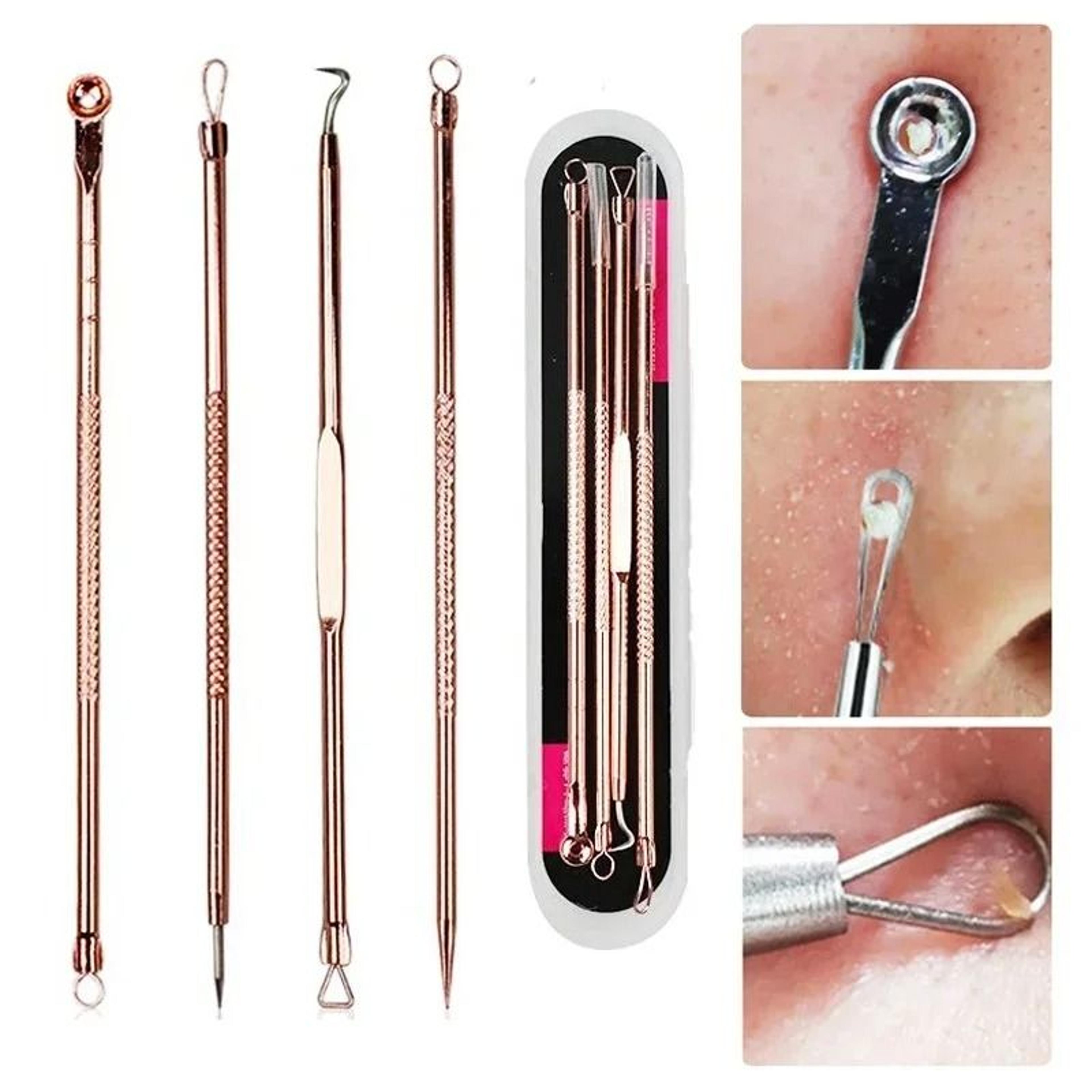 stainless steel pimple extractor and whitehead comedone removal kit