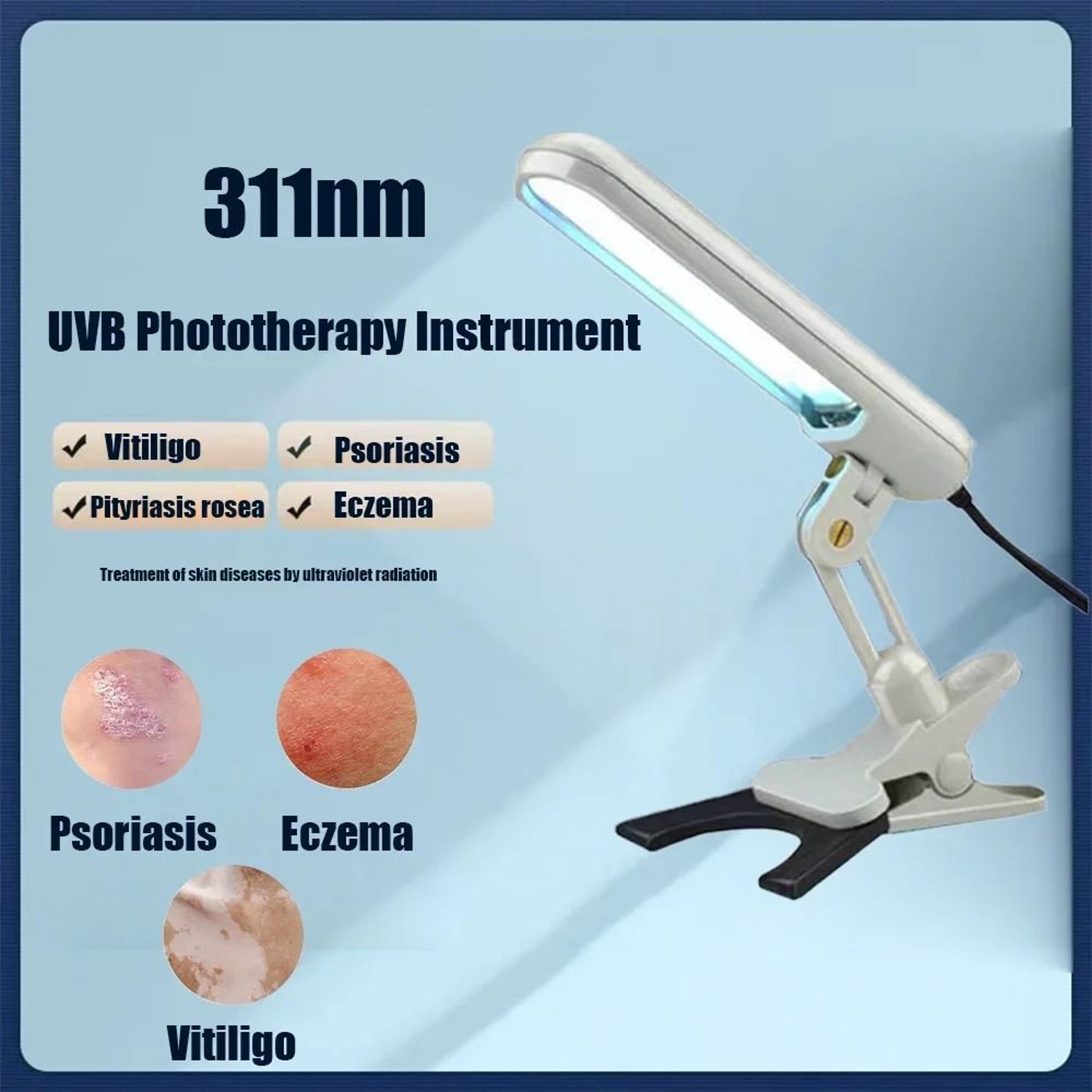 handheld psoriasis uvb phototherapy device and narrowband uv vitiligo instrument