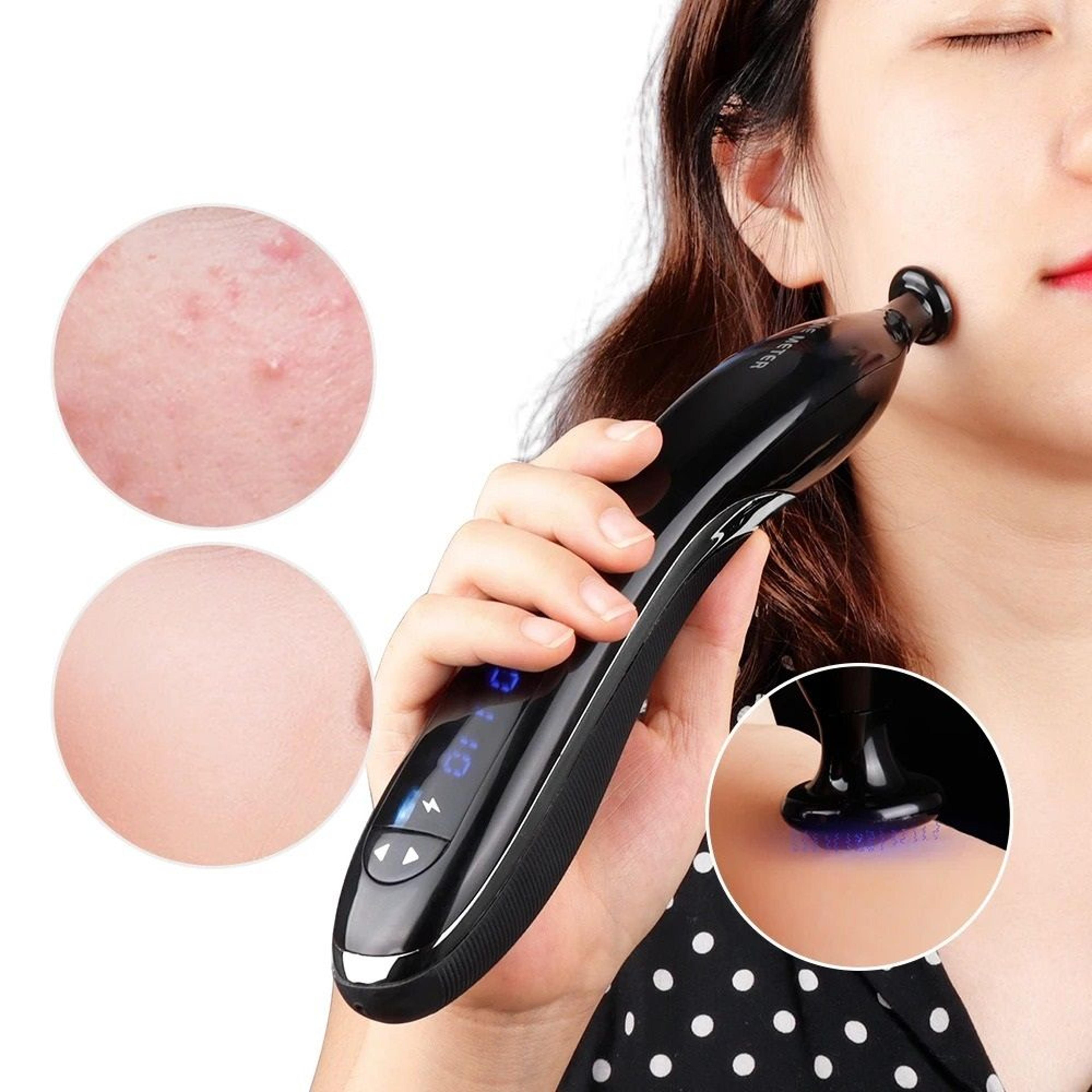 blue light ozone cold plasma acne treatment machine and anti-aging beauty pen
