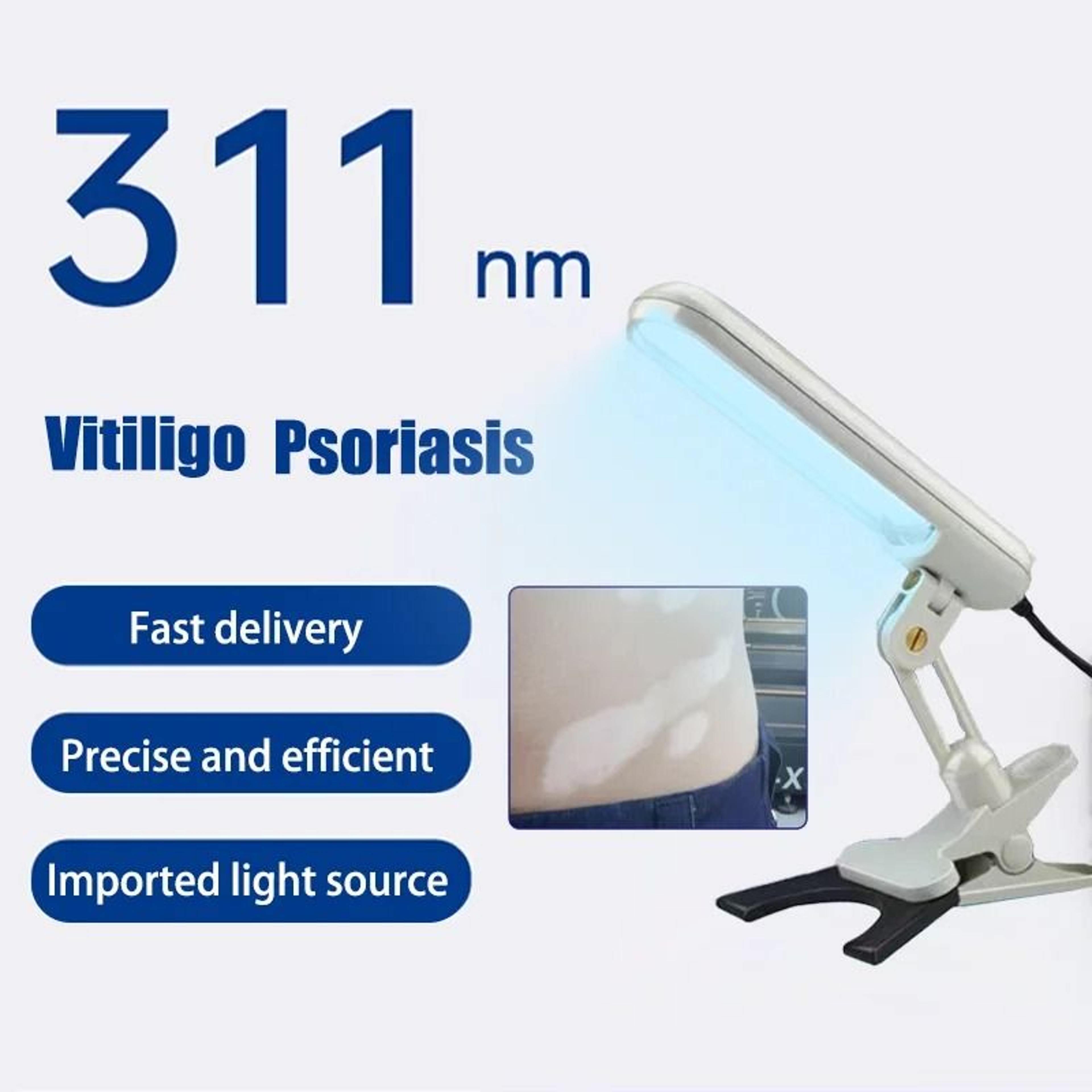 311nm narrowband uvb medical grade phototherapy lamp for skin health management